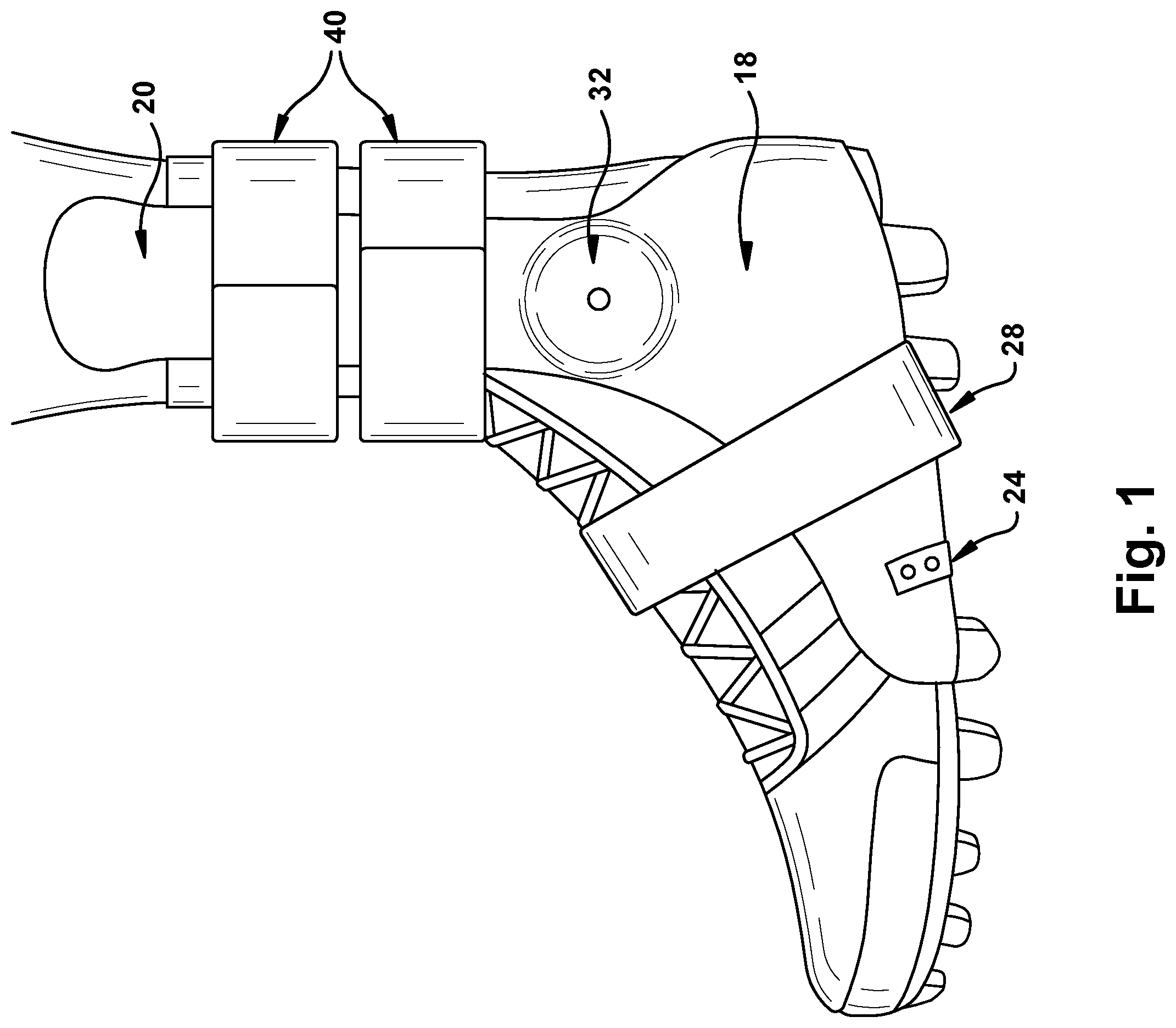 Patent US12403031 — External ankle brace — Figure 1