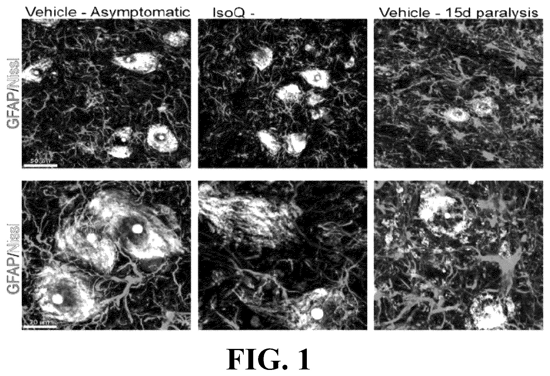 Patent US12403122 — Method for treating amyotrophic lateral sclerosis using quercetin-containing compositions — Figure 1