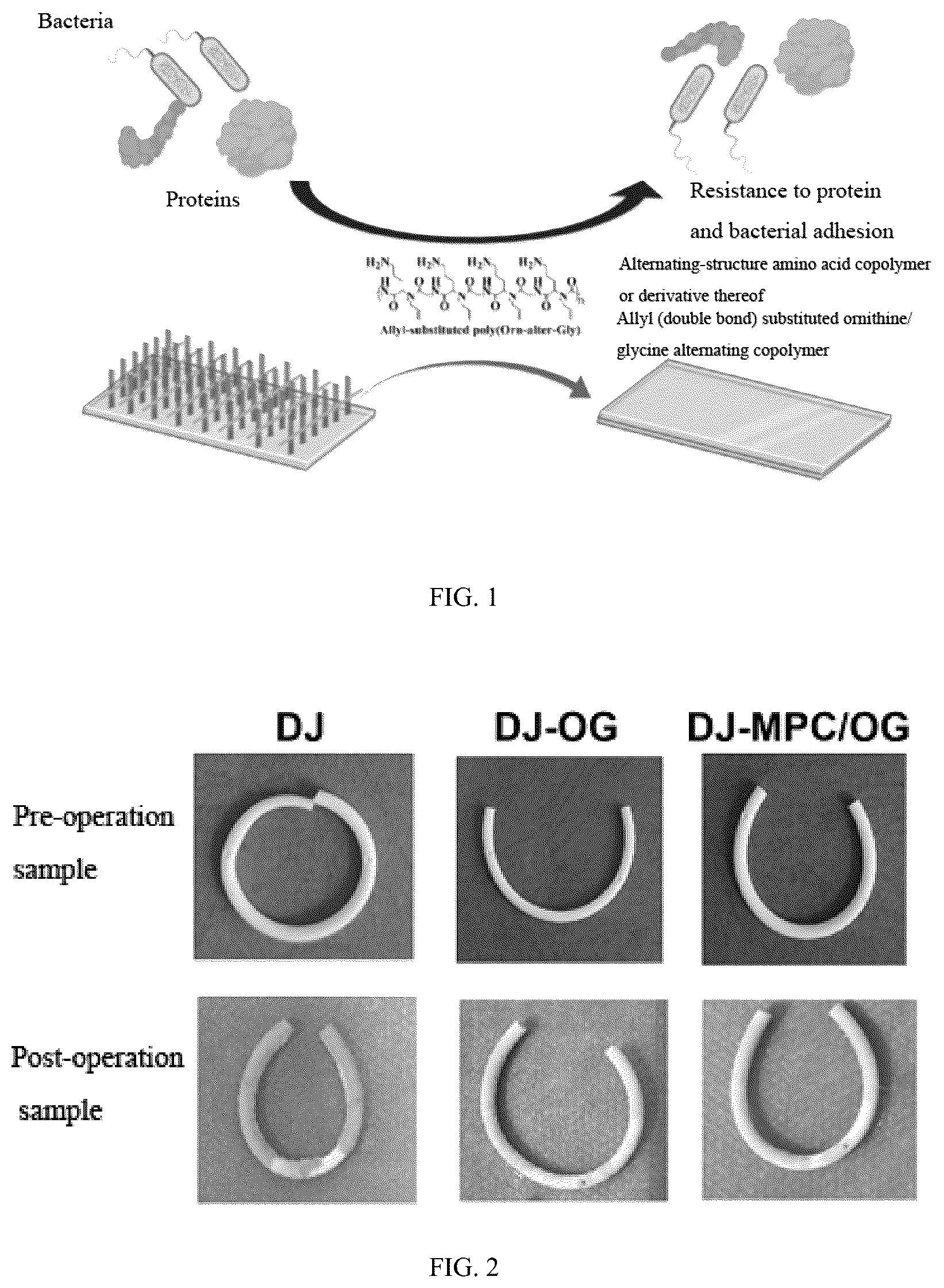 Patent US12403223 — Method for constructing hydrophilic antifouling coating on surface of medical implantable material — Figure 1