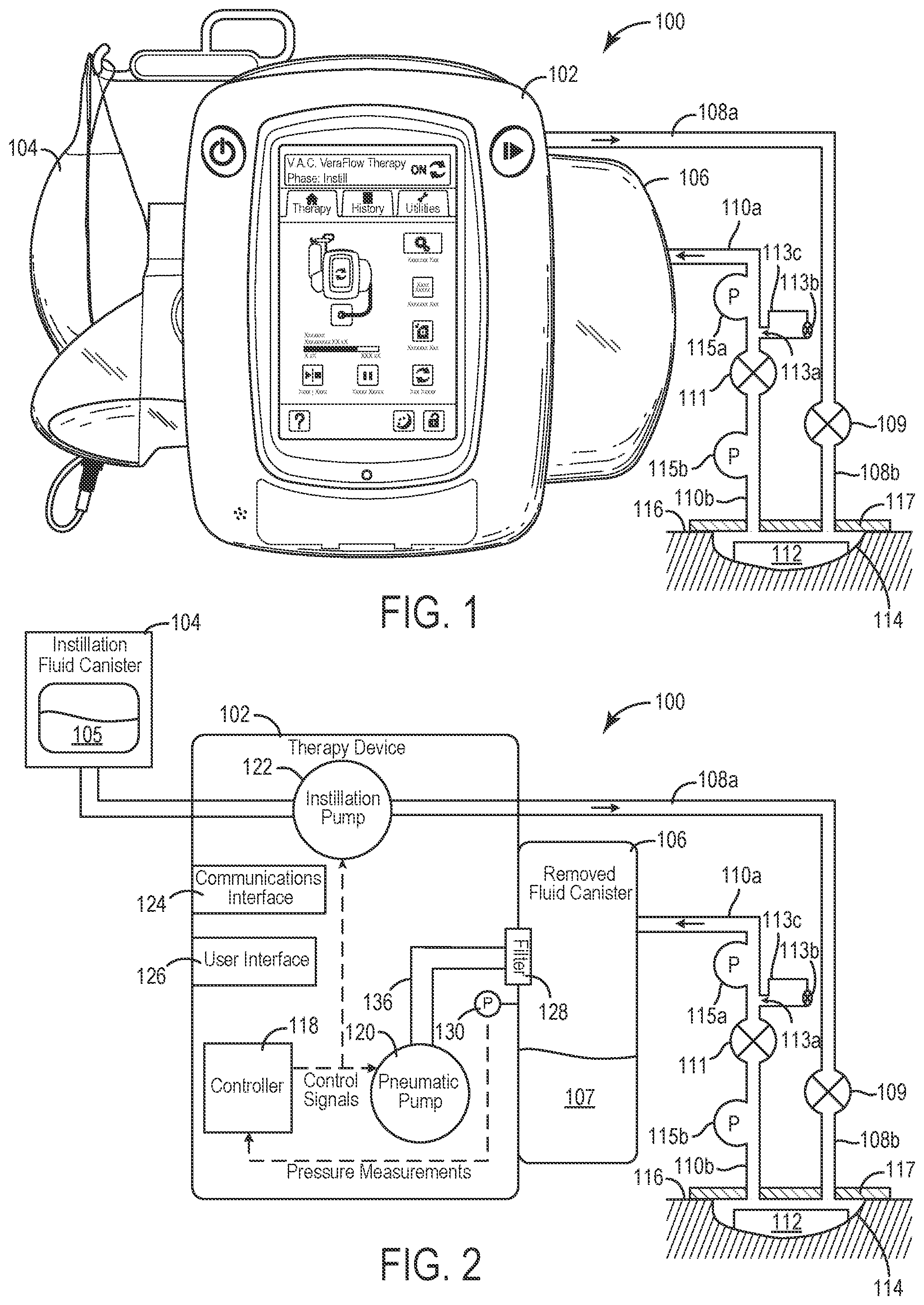 Patent US12403235 Figure 1 – Wound therapy system with internal alternating orifice