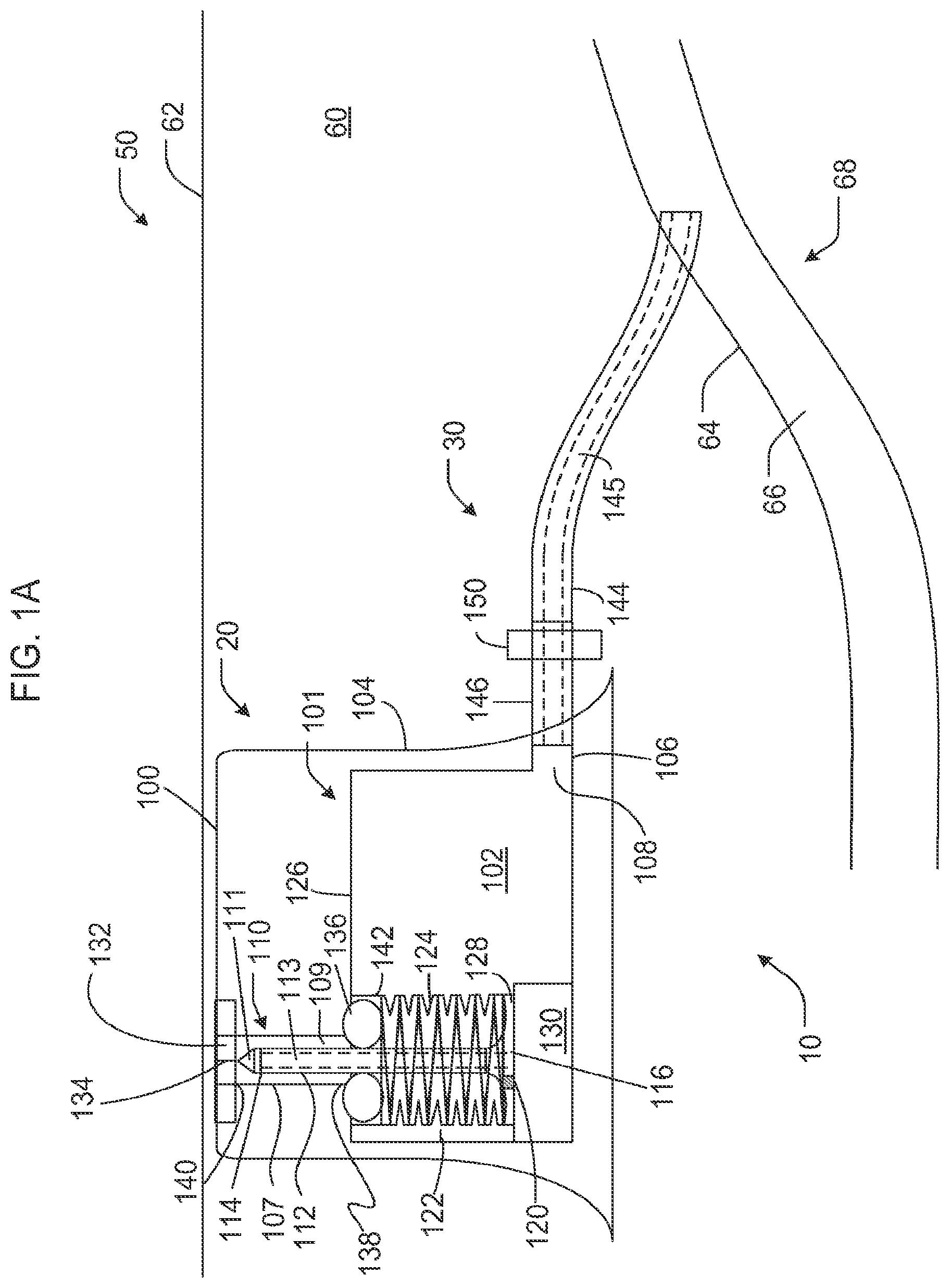 Patent US12403267 — Devices and methods for installation and removal of a needle tip of a needle — Figure 1