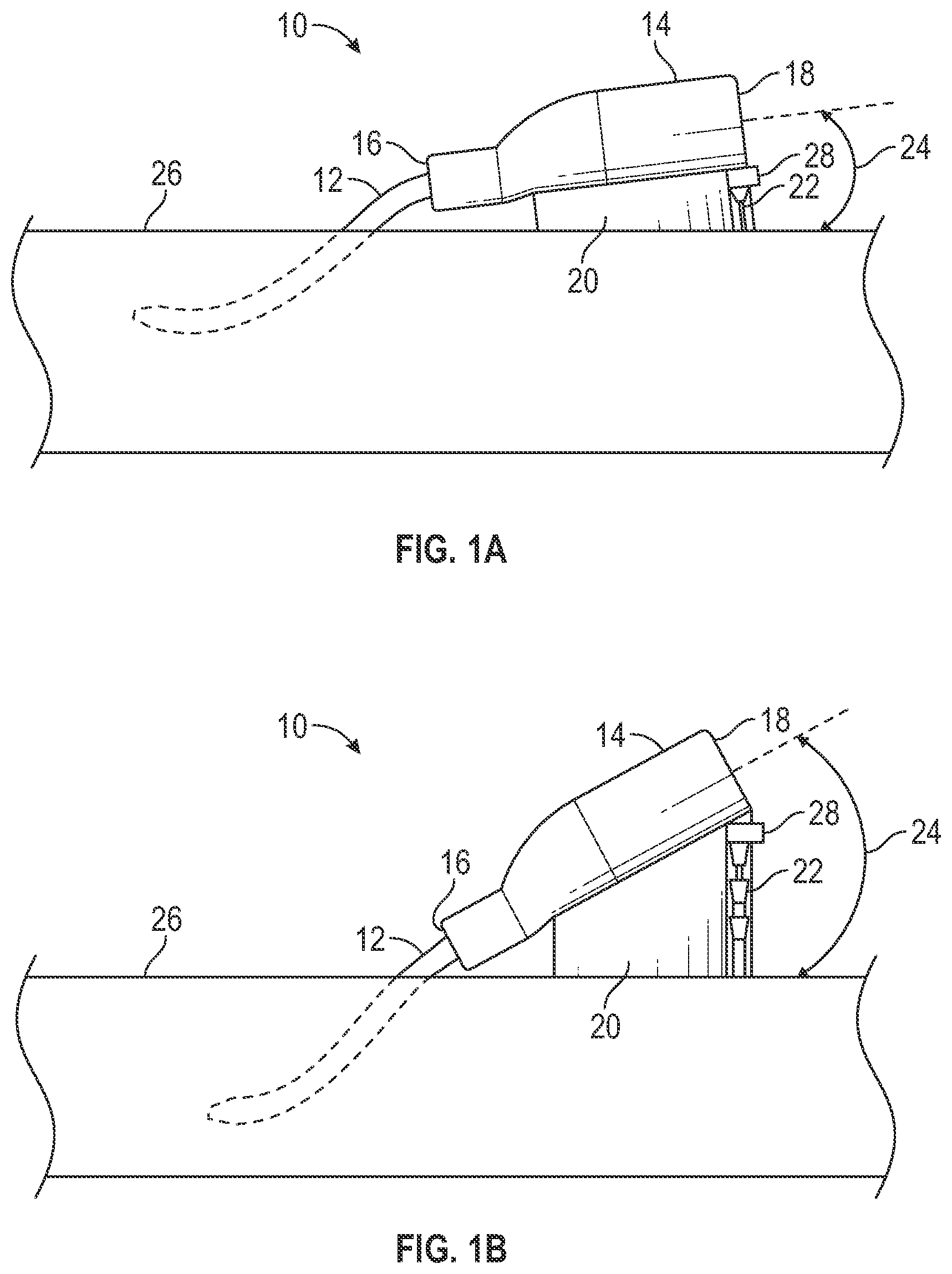 Patent US12403284 Figure 1 – Catheter assembly with angle changing and related methods