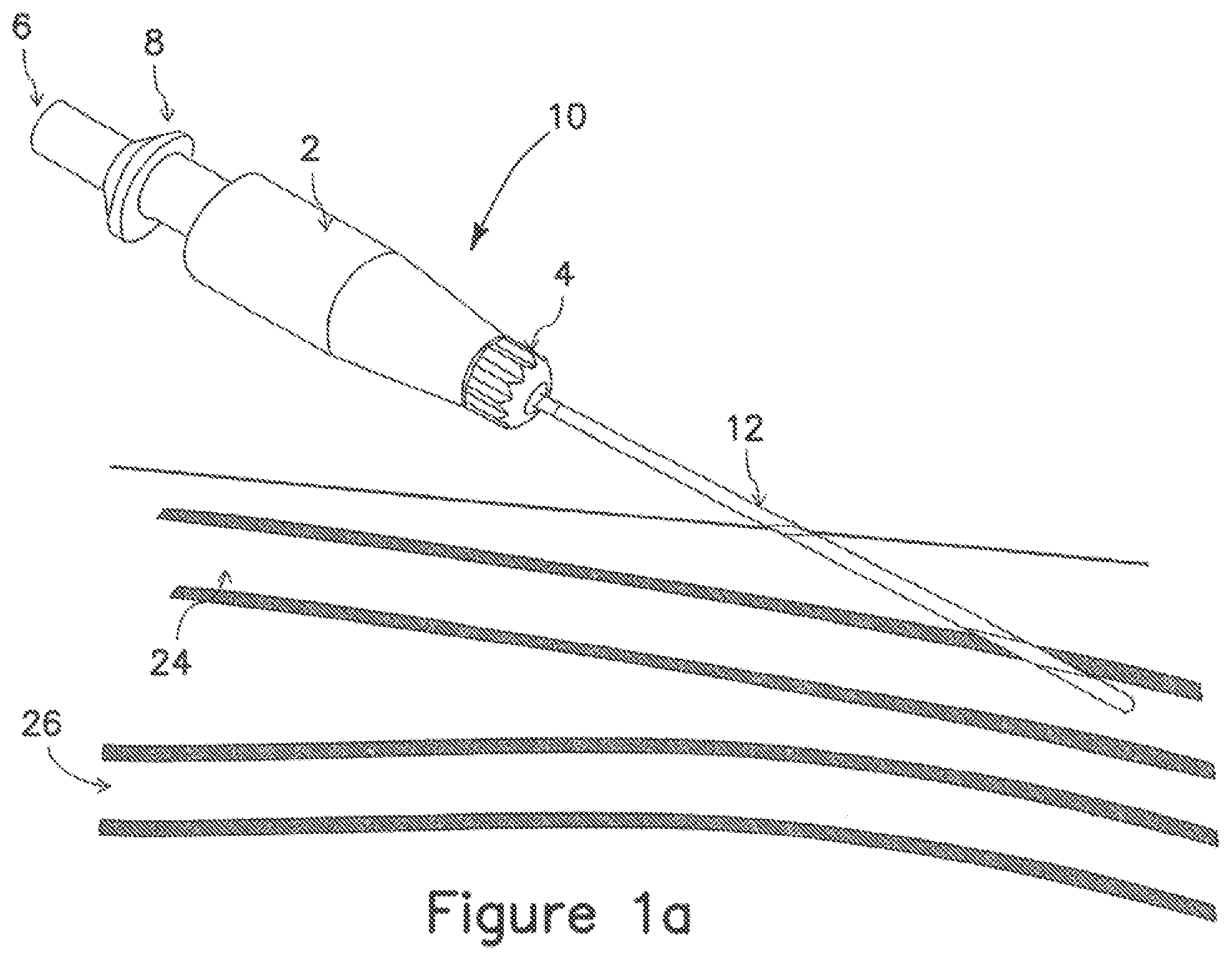 Patent US12403289 — Systems and methods for percutaneous intravascular access and guidewire placement — Figure 1
