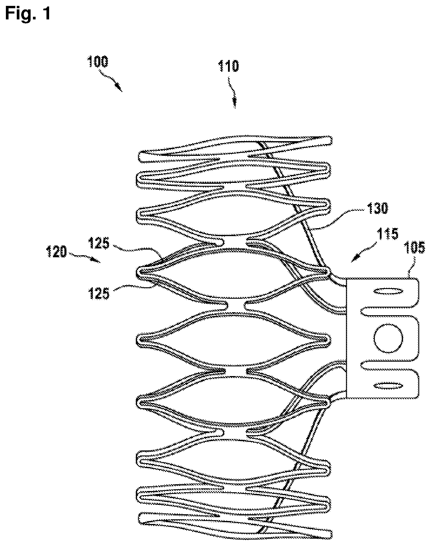 Patent US12403296 — Apparatus for anchoring a ventricular assist system in a blood vessel, operating method, production method for producing an apparatus and ventricular assist system — Figure 1