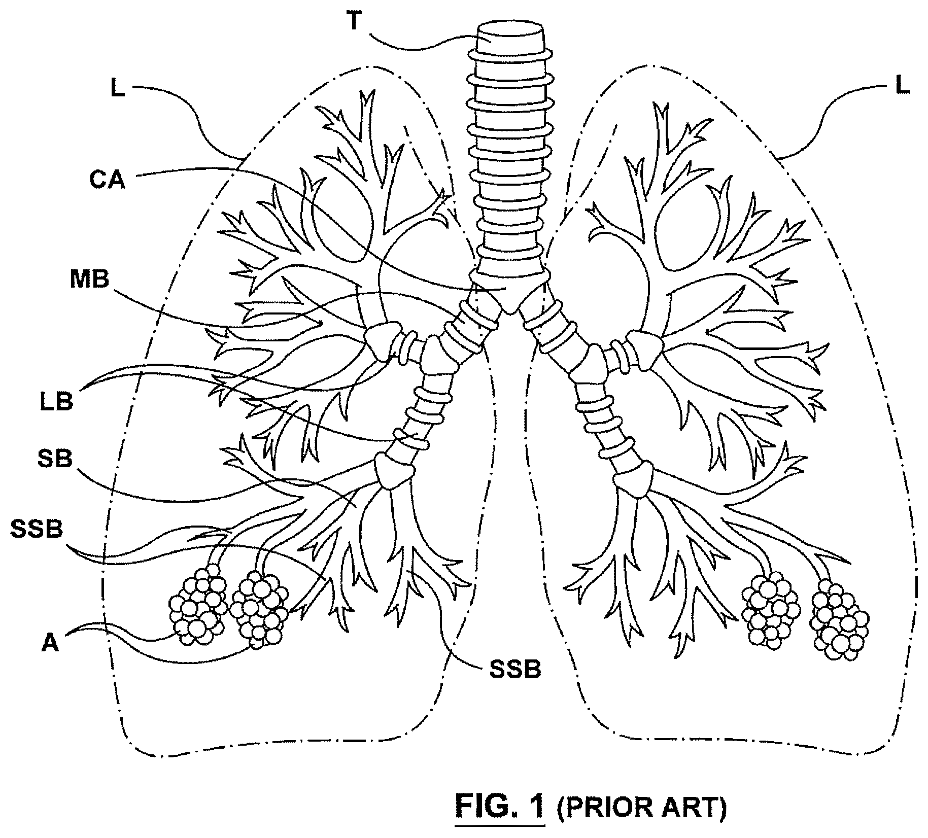 Patent US12403305 — Immunostimulation in the treatment of viral infection — Figure 1