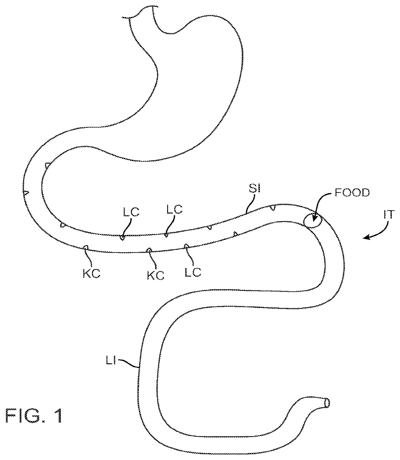 Patent US12403308 — Swallowable capsule and method for stimulating incretin production within the intestinal tract — Figure 1