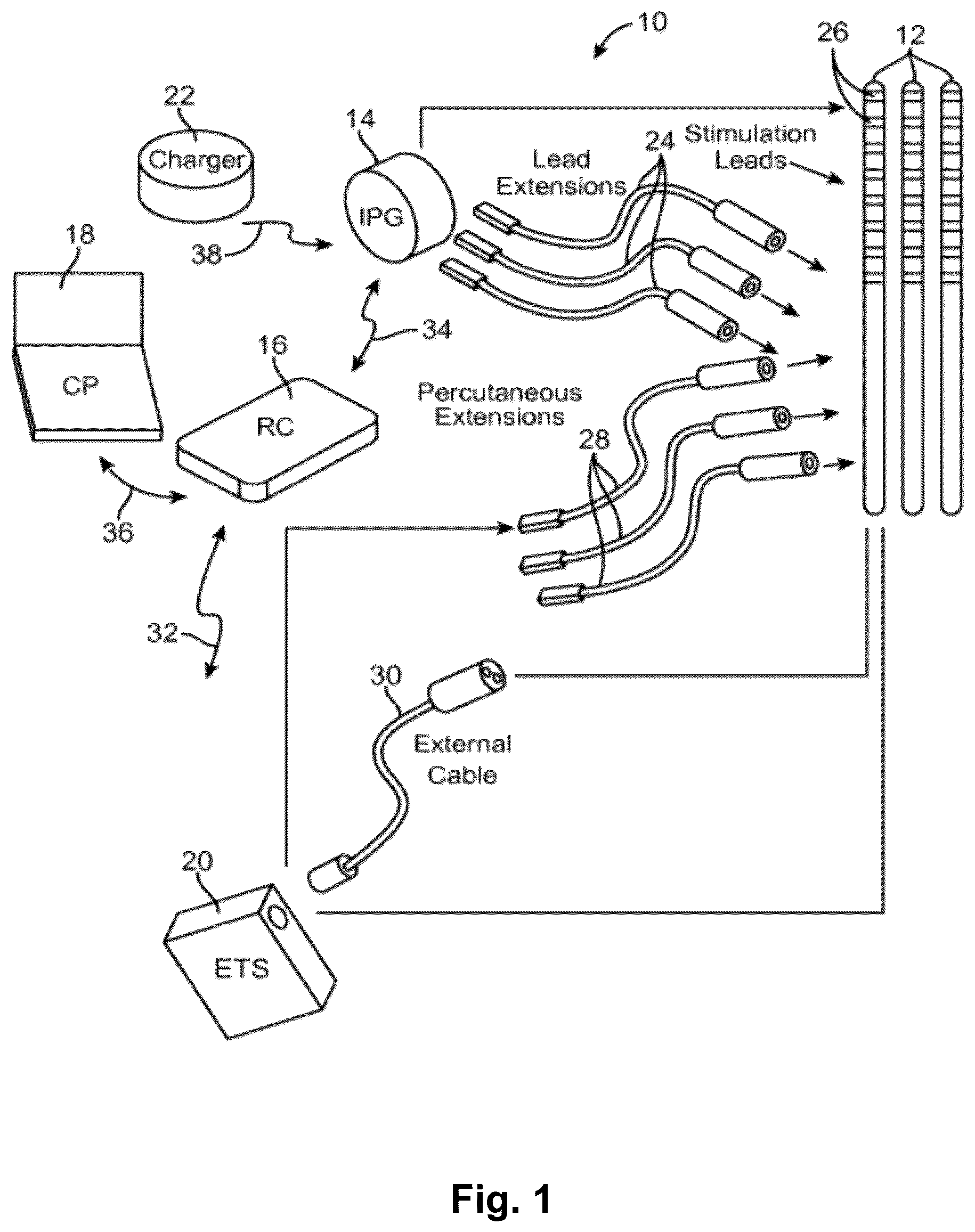 Patent US12403315 — Systems and methods for automated programming of electrical stimulation — Figure 1