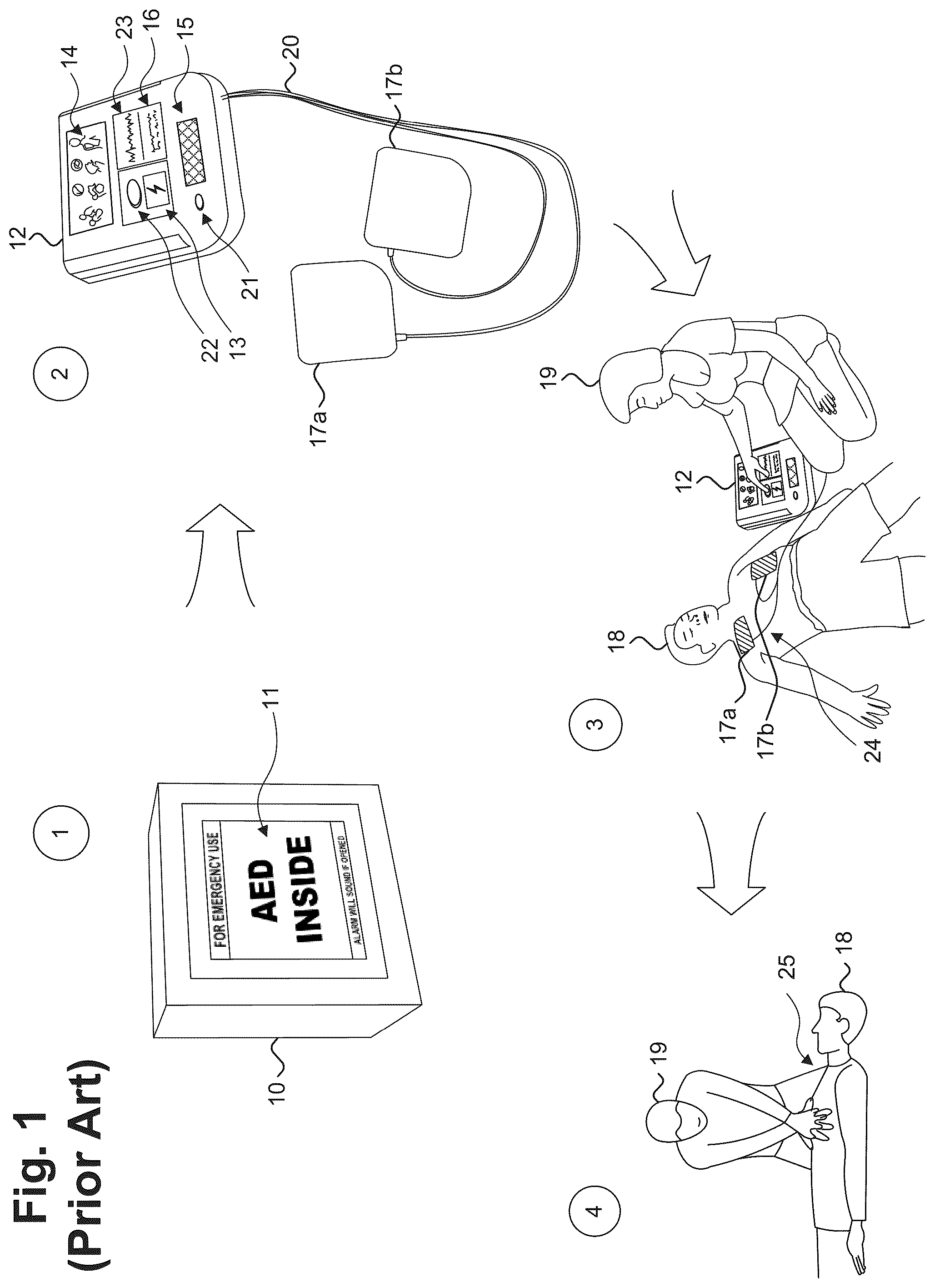 Patent US12403323 — Defibrillation assembly energizable through case opening — Figure 1