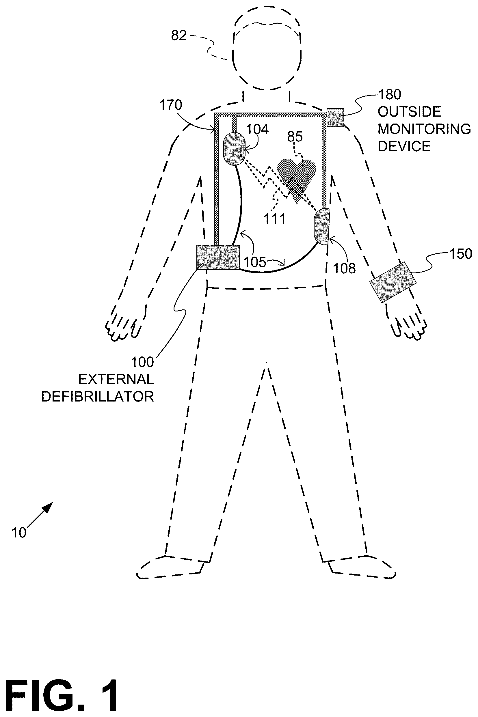 Patent US12403324 — Wearable medical device (WMD) implementing adaptive techniques to save power — Figure 1