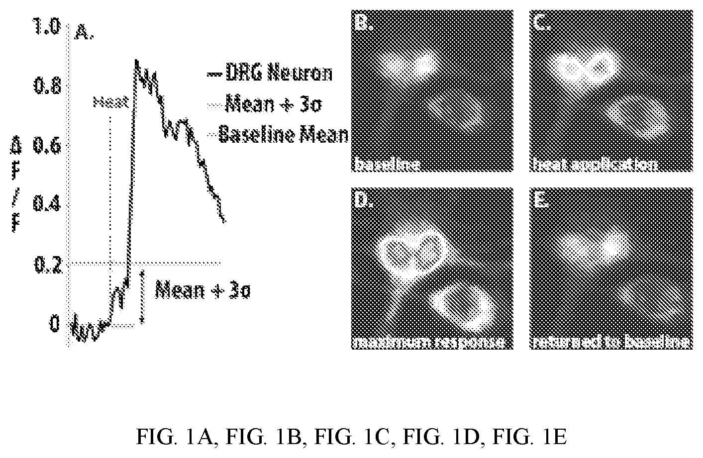 Patent US12410428 — RNA-guided transcriptional regulation and methods of using the same for the treatment of back pain — Figure 1