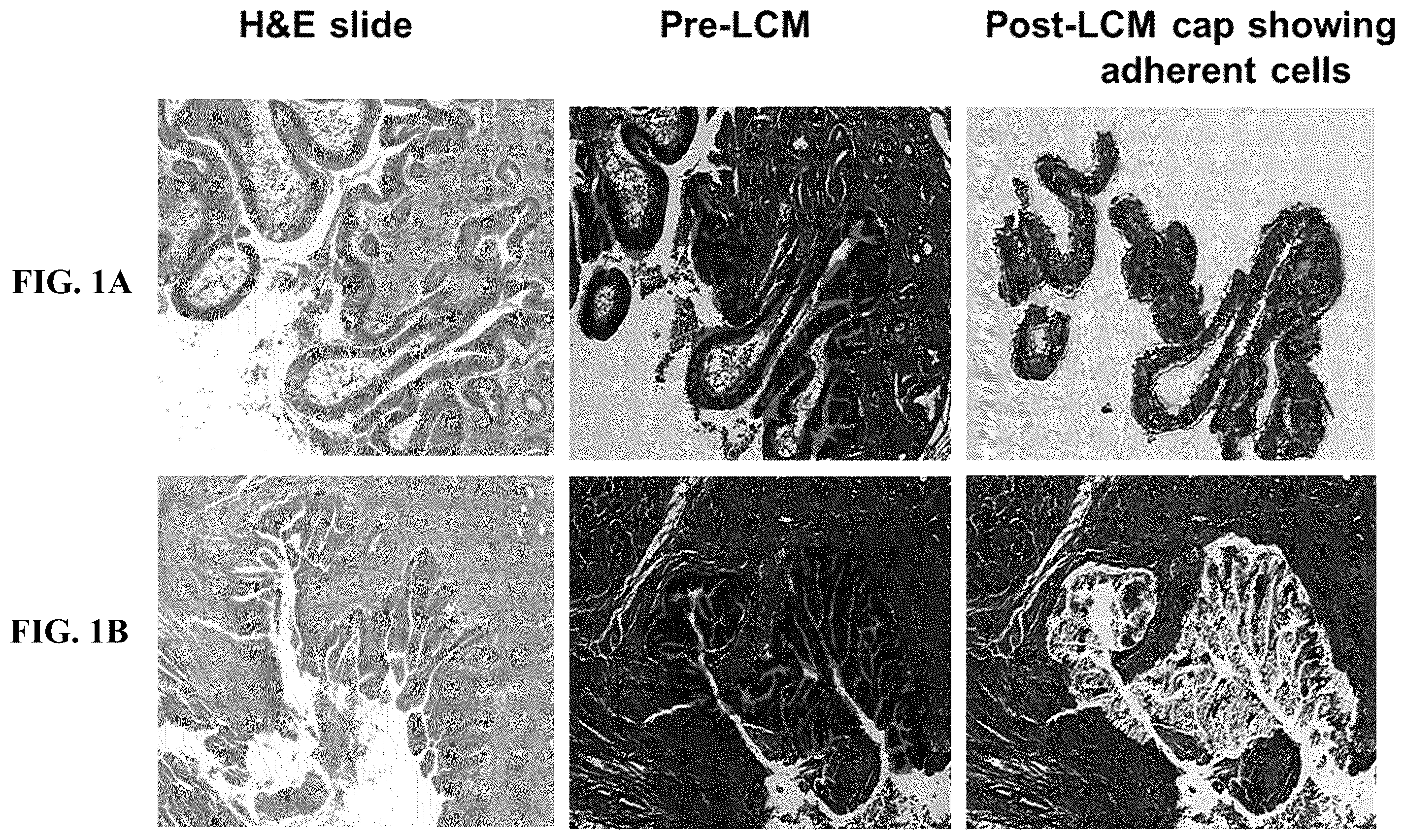 Patent US12410479 — Microrna assay for detection and management of pancreatic cancer precursors — Figure 1
