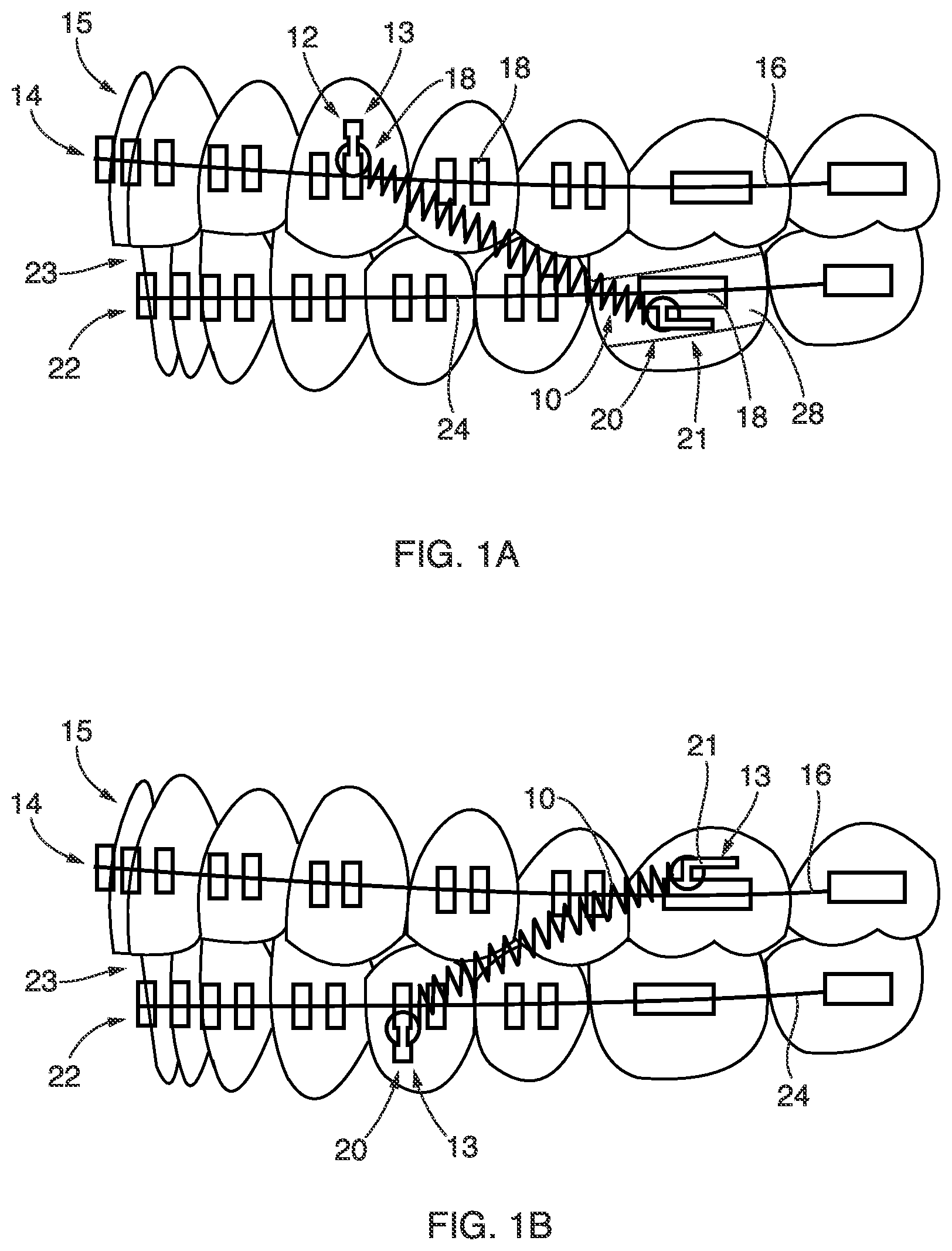 Patent US12410844 — Systems and methods for providing advanced springs — Figure 1