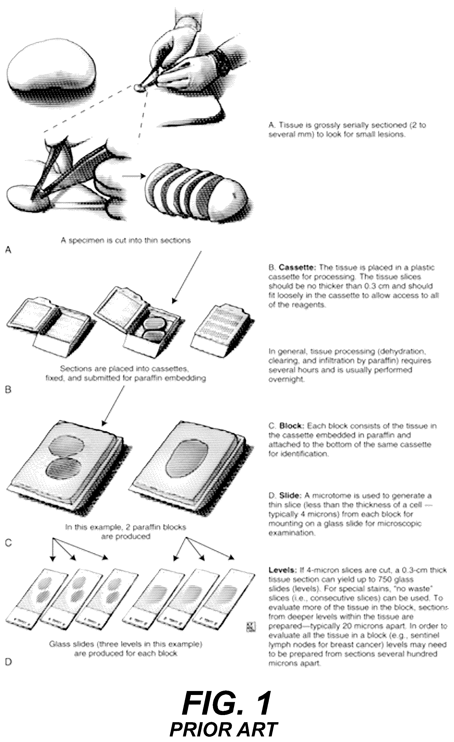 Patent US12417530 — Systems and methods to process electronic images to provide localized semantic analysis of whole slide images — Figure 1