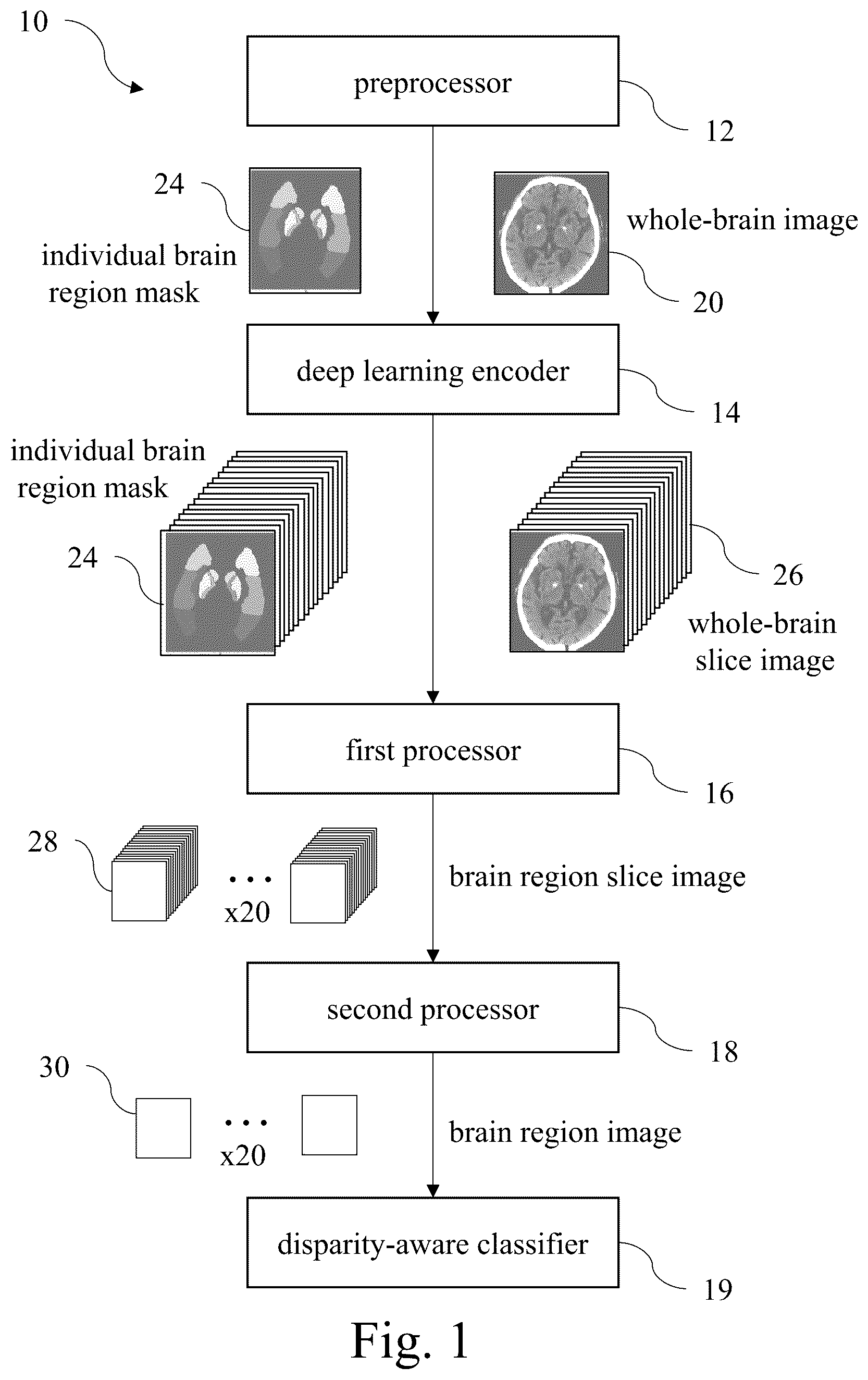 Patent US12417536 — Automated detection system for acute ischemic stroke — Figure 1
