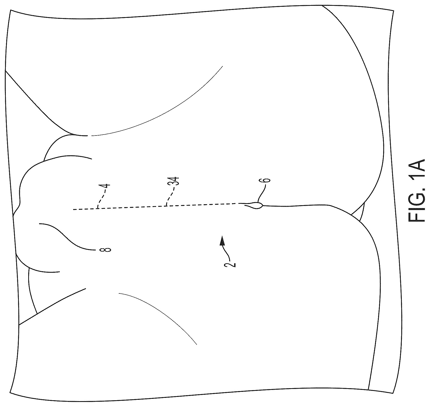 Patent US12426594 — Cryoprotective compositions and methods for protection of a surgical site during cryosurgery — Figure 1