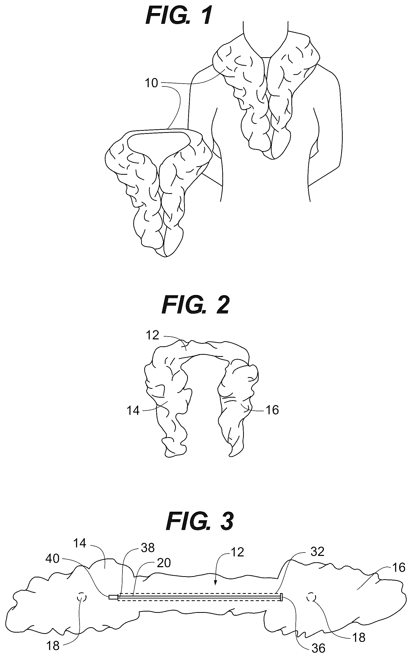 Patent US12426653 — Pre-configured scarf with built-in closure — Figure 1
