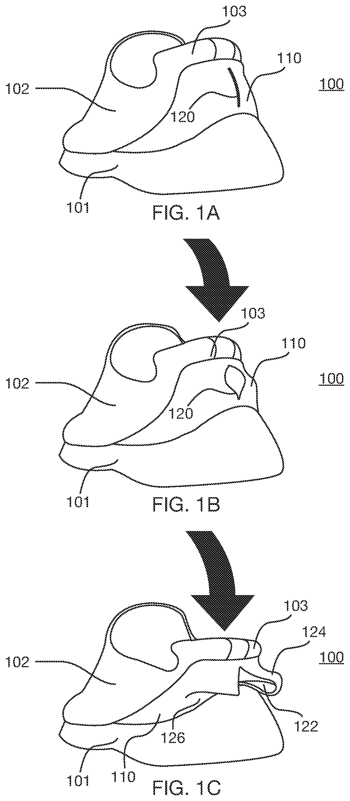 Patent US12426666 — Rapid-entry footwear having a split back — Figure 1