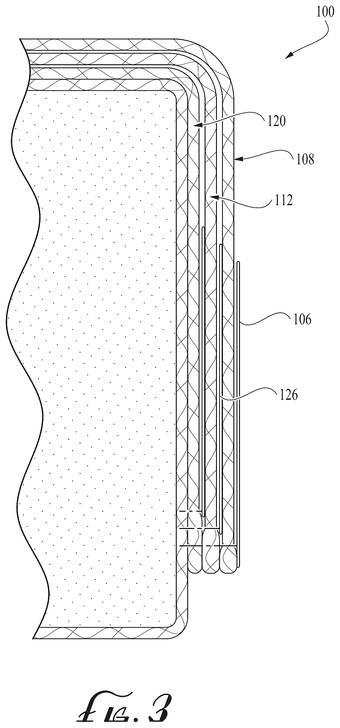 Patent US12426731 Figure 3 – Mattress cover with removable fabric layers