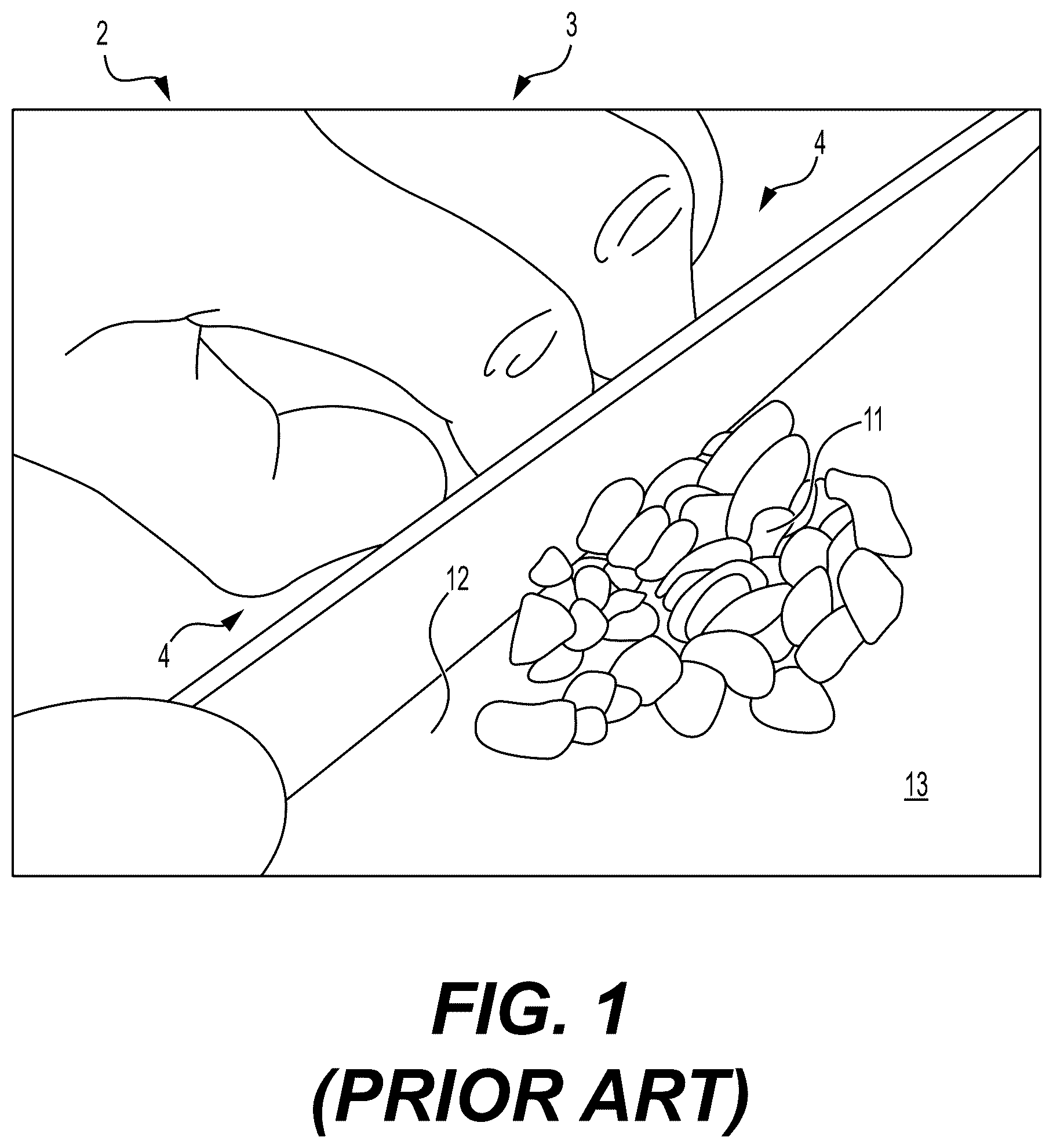Patent US12426742 — Hand-held multi-purpose kitchen tool — Figure 1