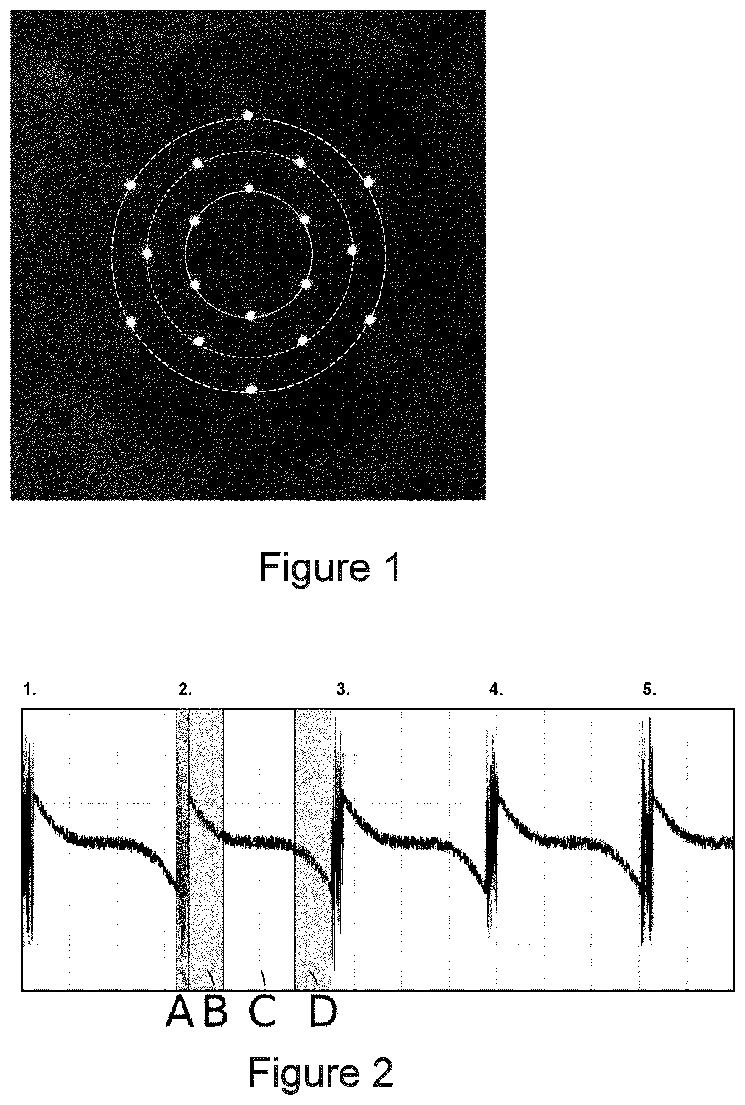 Patent US12426778 — Method for ascertaining physiologically correct biometric data of an eye — Figure 1
