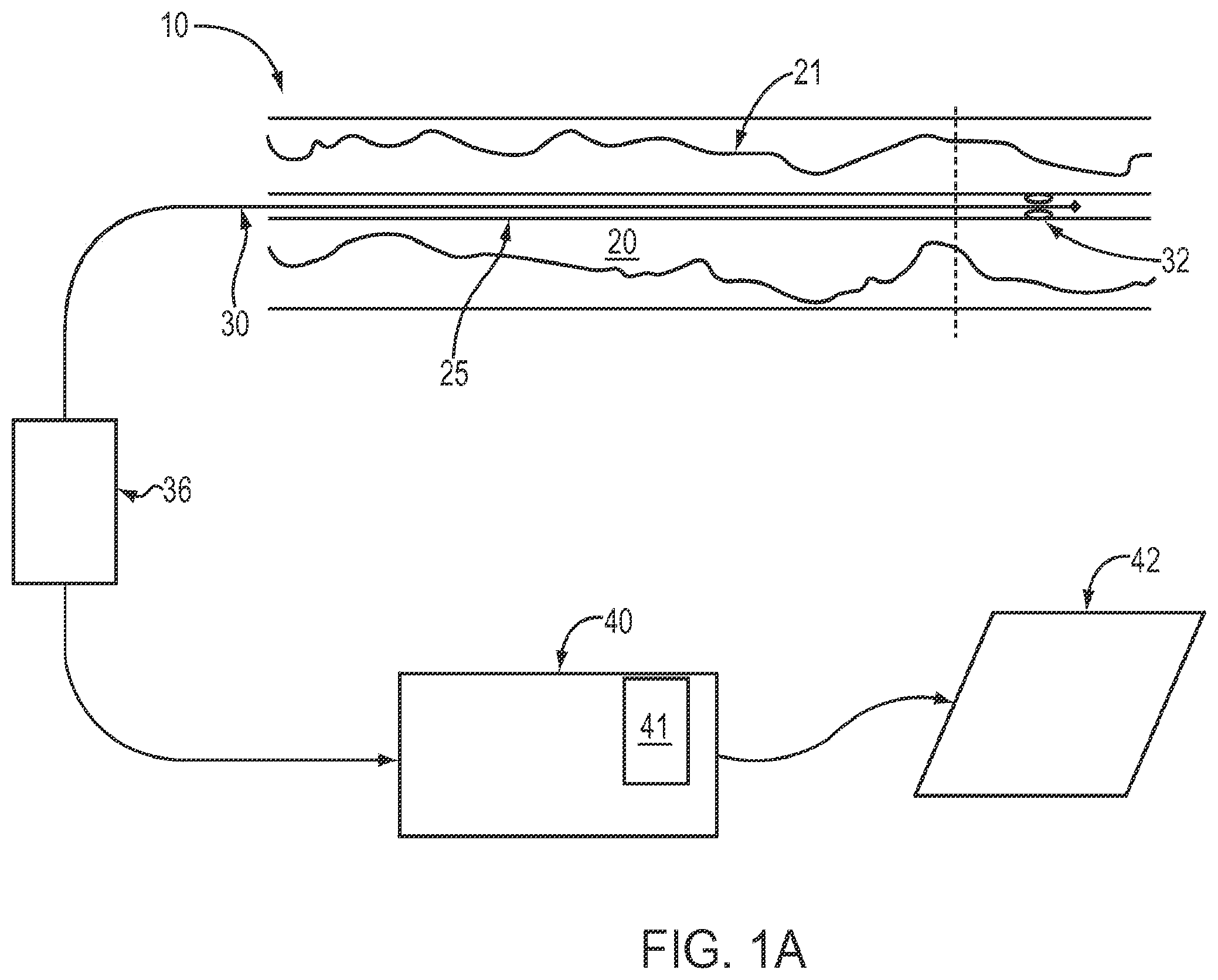 Patent US12426789 Figure 1 – Blood vessel lumen morphology and minimum lumen area measurements data collection by intravascular imaging systems for stenosis or stent planning