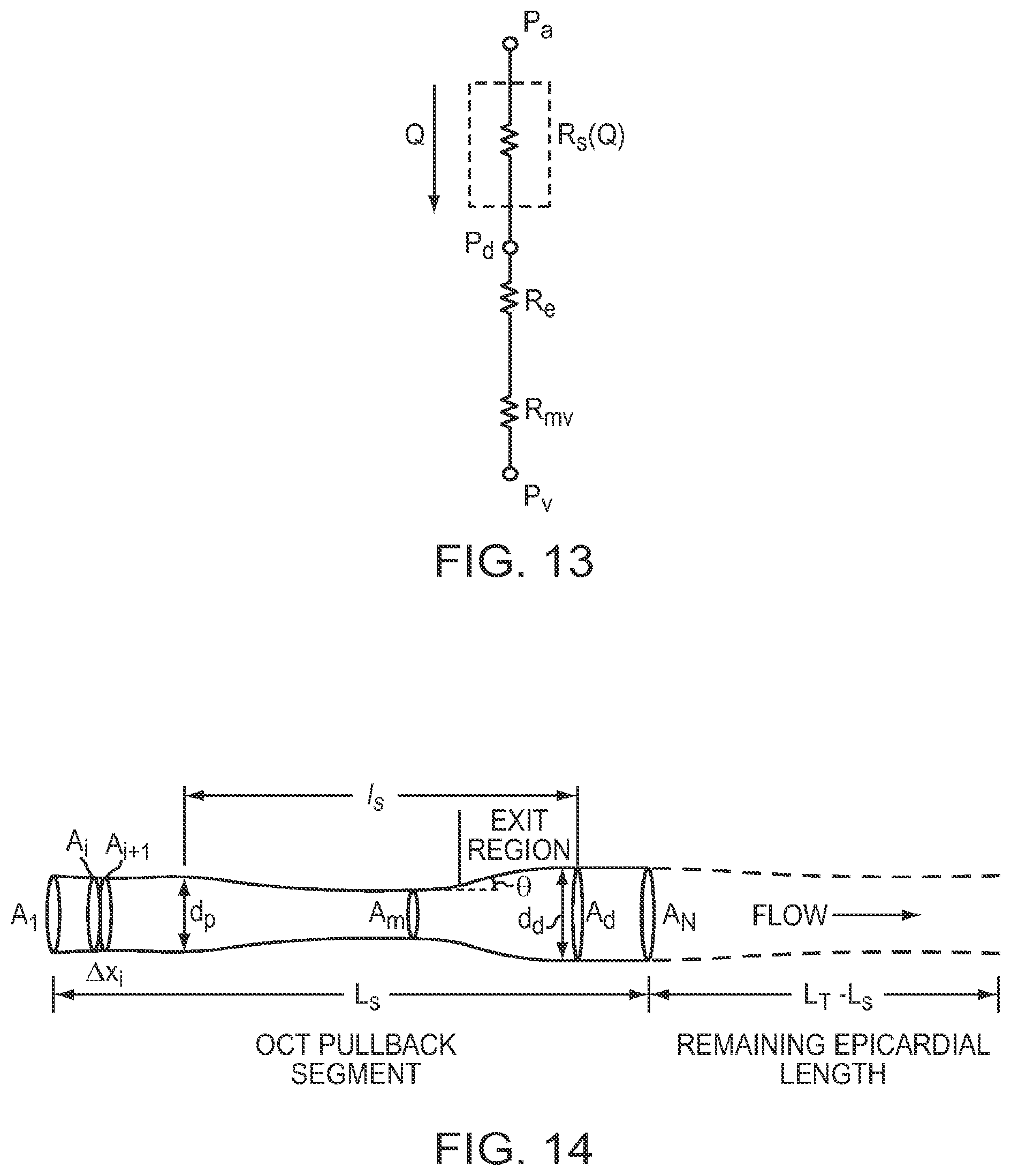 Patent US12426789 Figure 13 – Blood vessel lumen morphology and minimum lumen area measurements data collection by intravascular imaging systems for stenosis or stent planning
