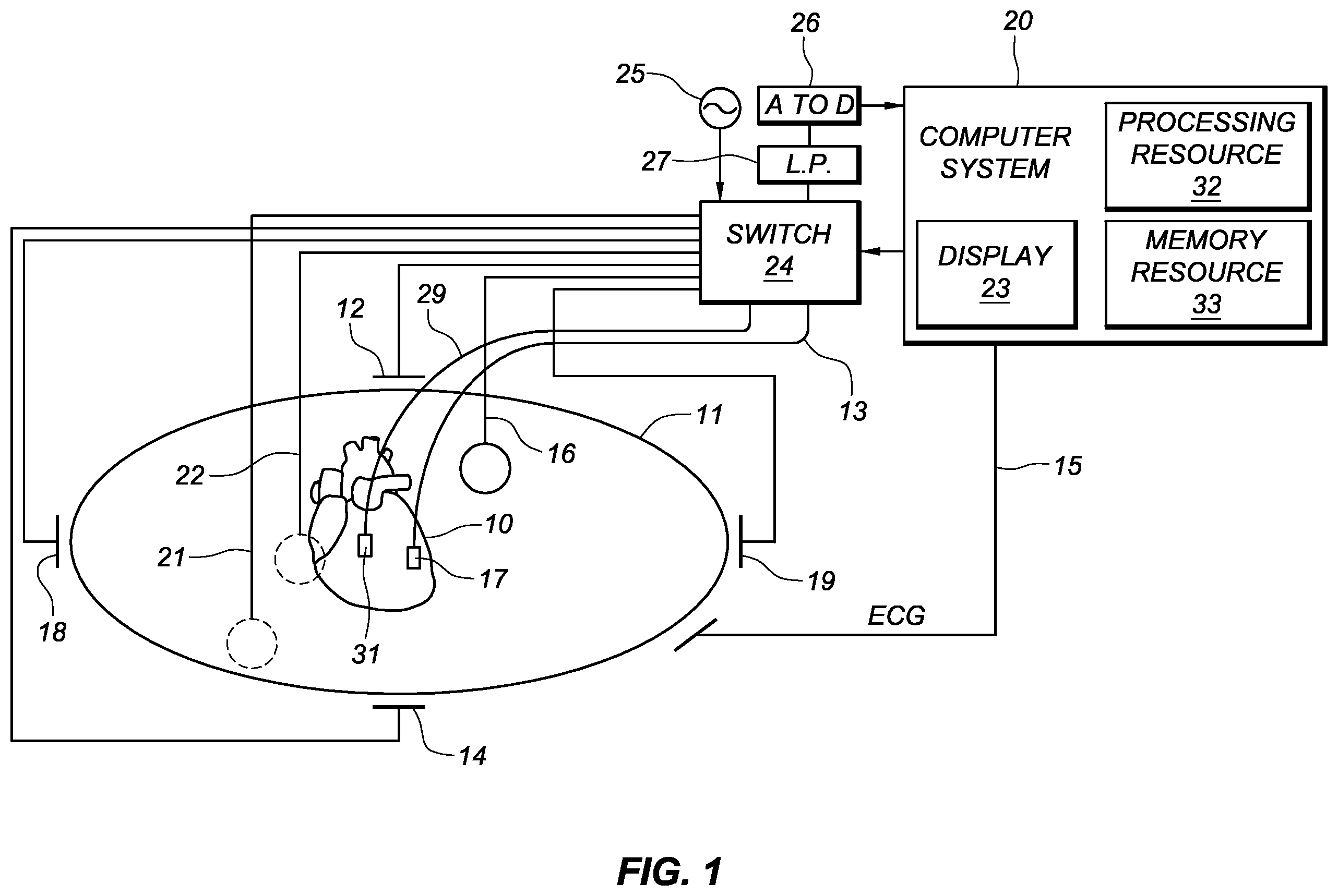 Patent US12426799 — Determination of catheter shape — Figure 1