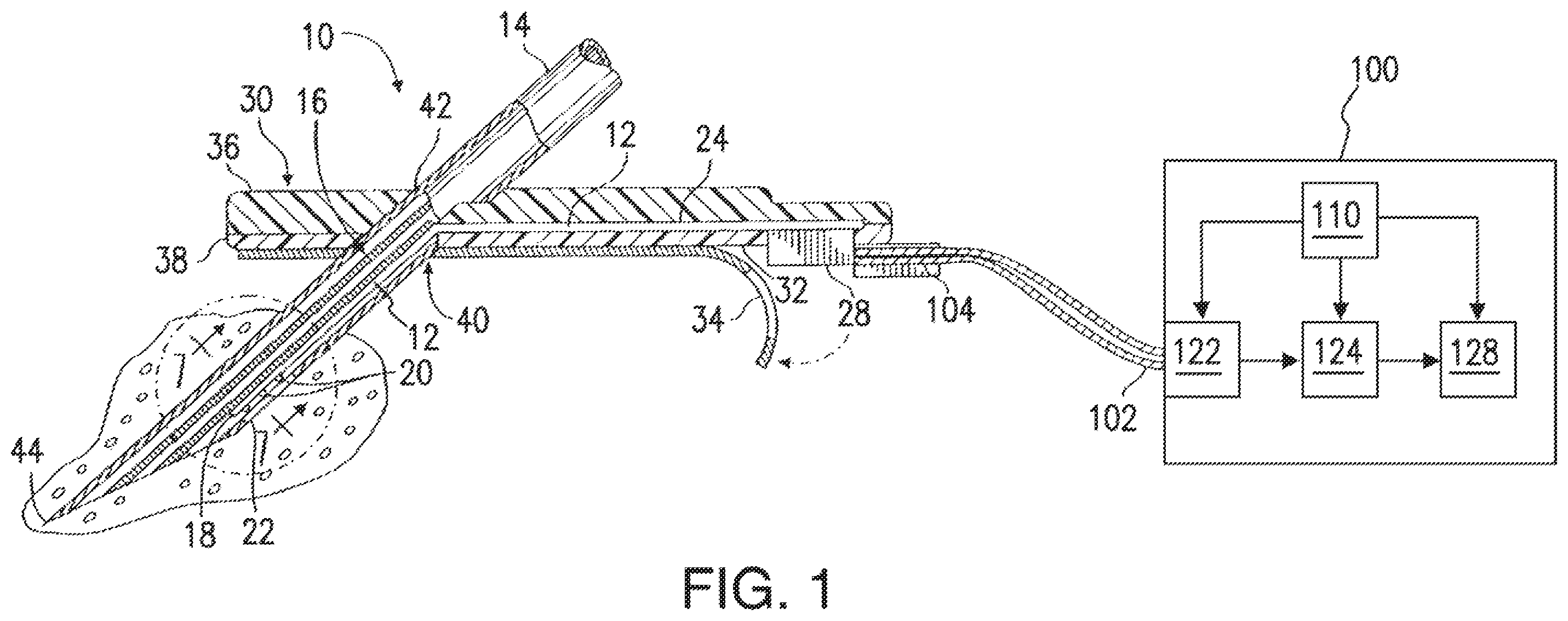 Patent US12426810 — Methods, systems, and devices for sensor fusion — Figure 1