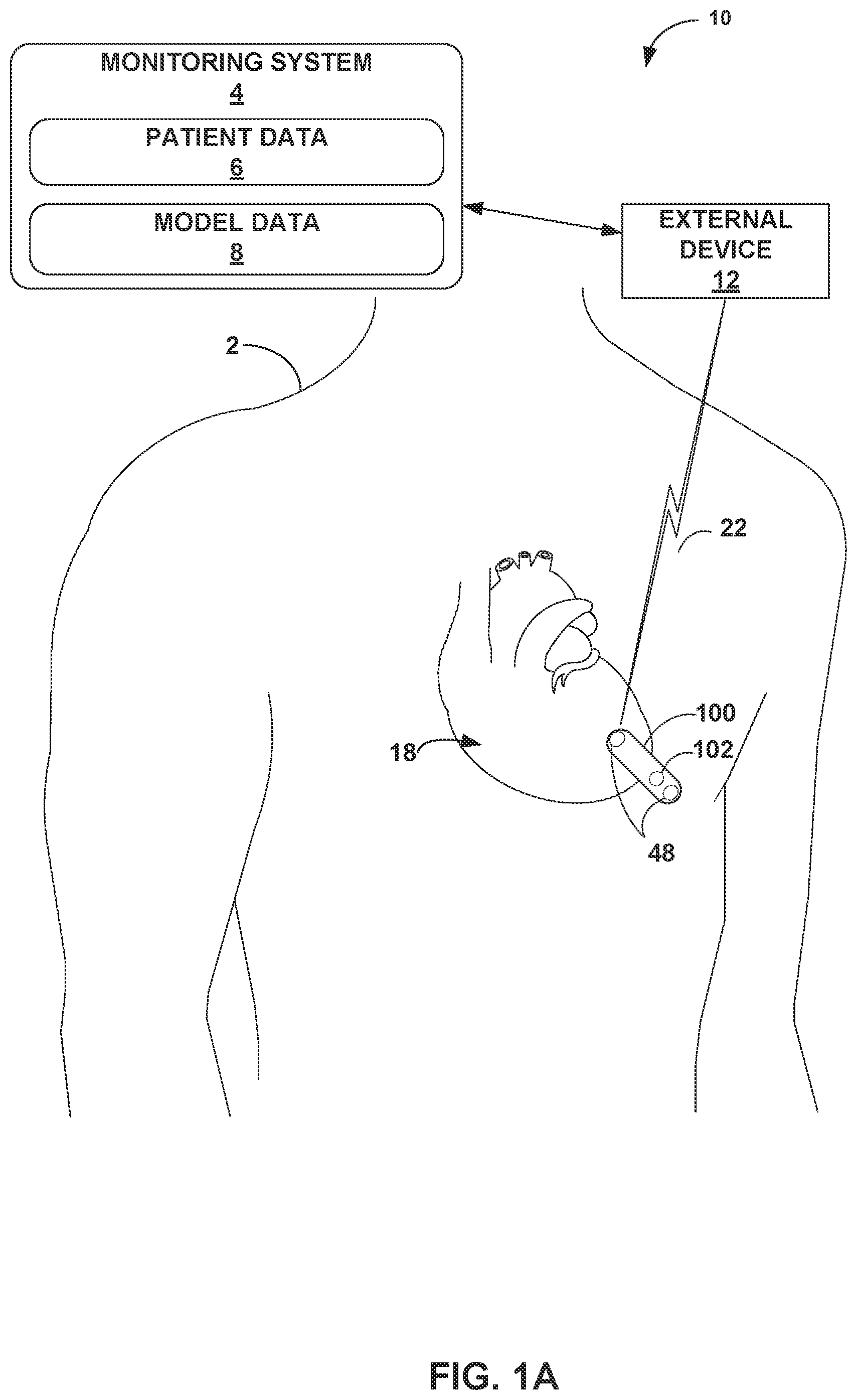 Patent US12426811 — Detection of changes in patient health based on glucose data — Figure 1