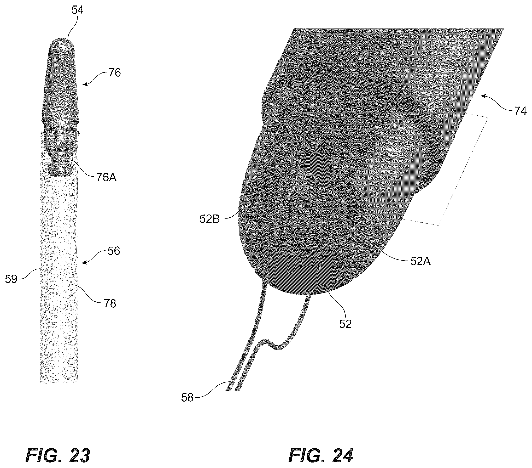 Patent US12426817 Figure 14 – Assembly for deploying a sensor within a bladder