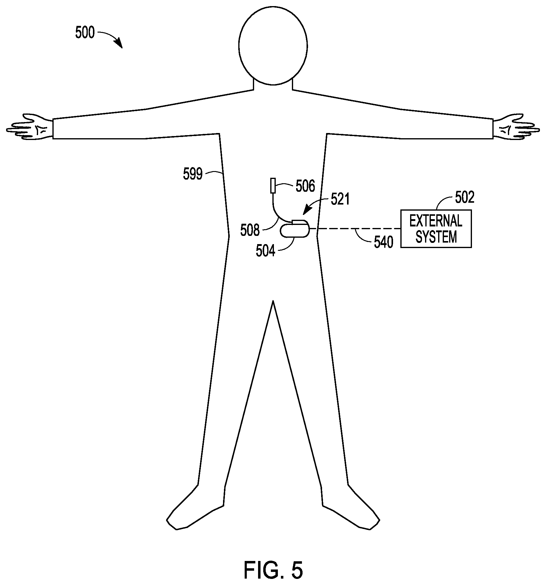 Patent US12426827 Figure 3 – Method and apparatus for sequencing sensing blocks for neuromodulation