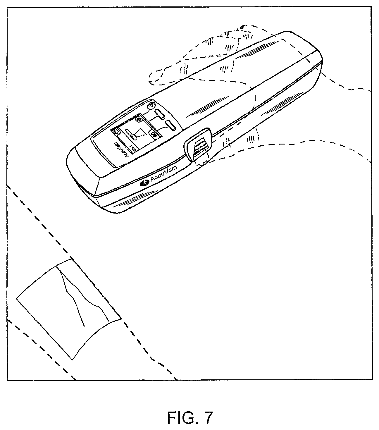Patent US12426835 Figure 7 – Vein scanner with housing configured for single-handed lifting and use