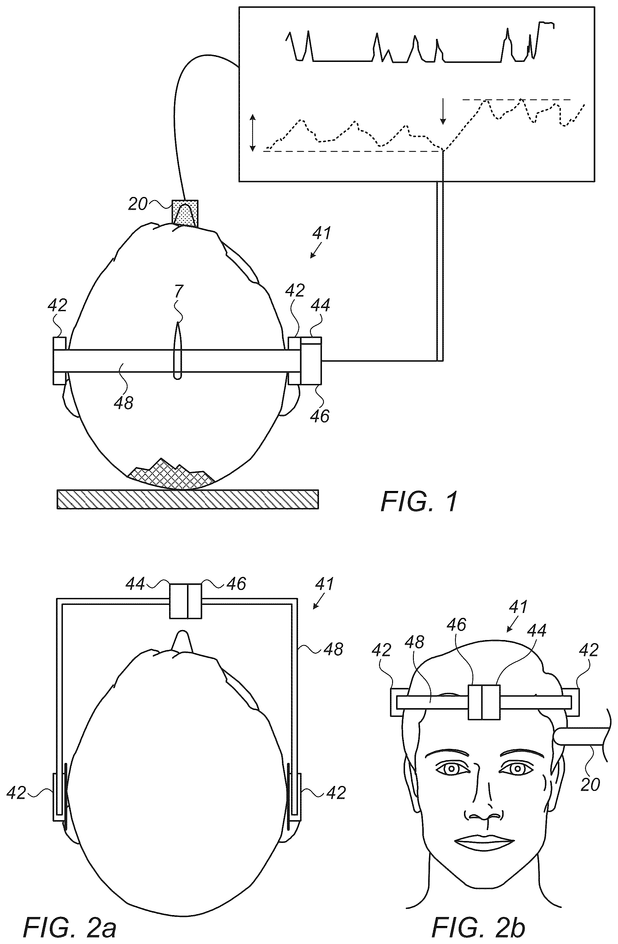 Patent US12426849 — Method and apparatus for noninvasive absolute (mean) intracranial pressure (A-ICP) measurement and/or monitoring — Figure 1