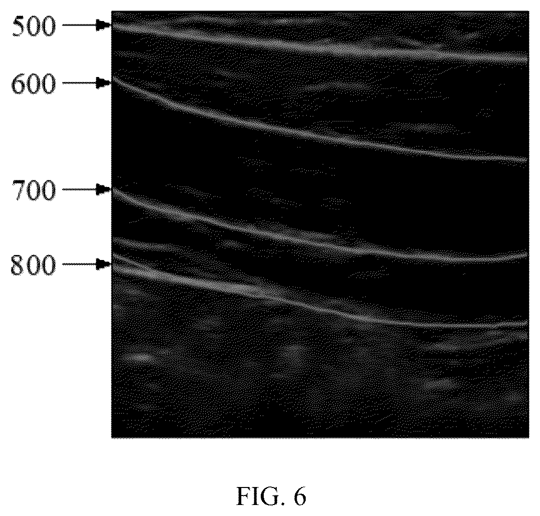 Patent US12426851 Figure 6 – Method, system, apparatus and medium for monitoring abdominal respiration based on ultrasound image