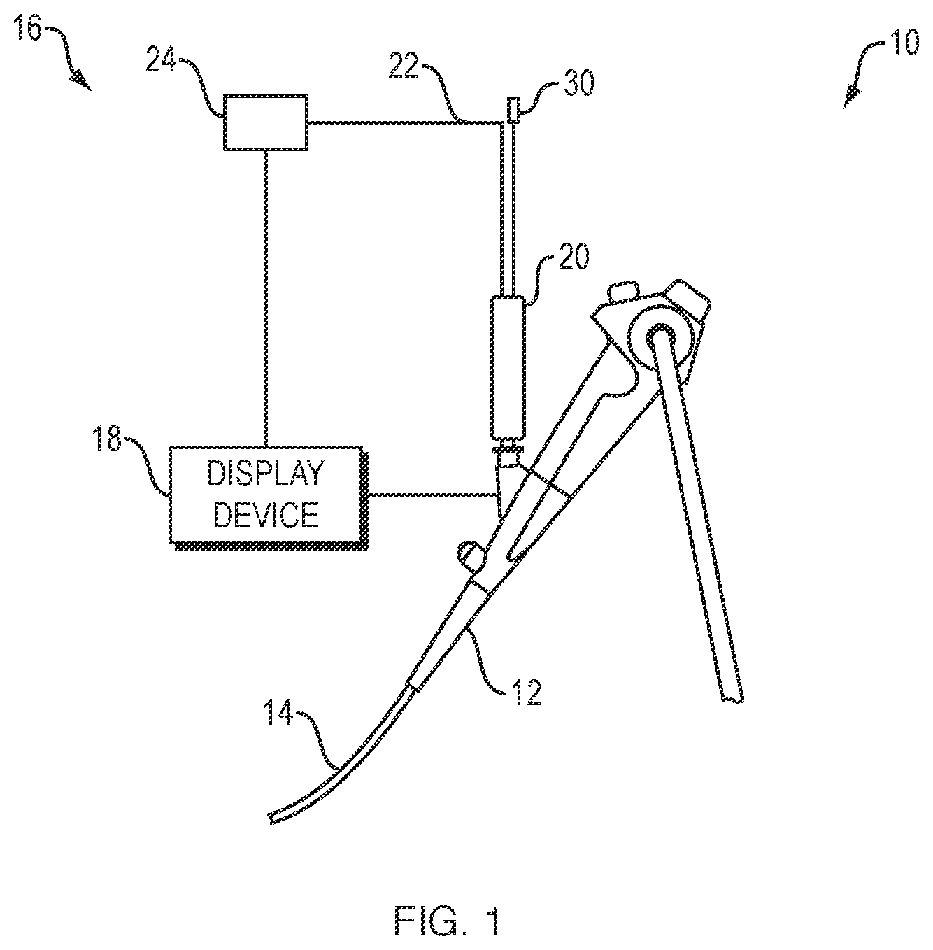 Patent US12426853 Figure 1 – Orientation pins for device using radial ultrasound