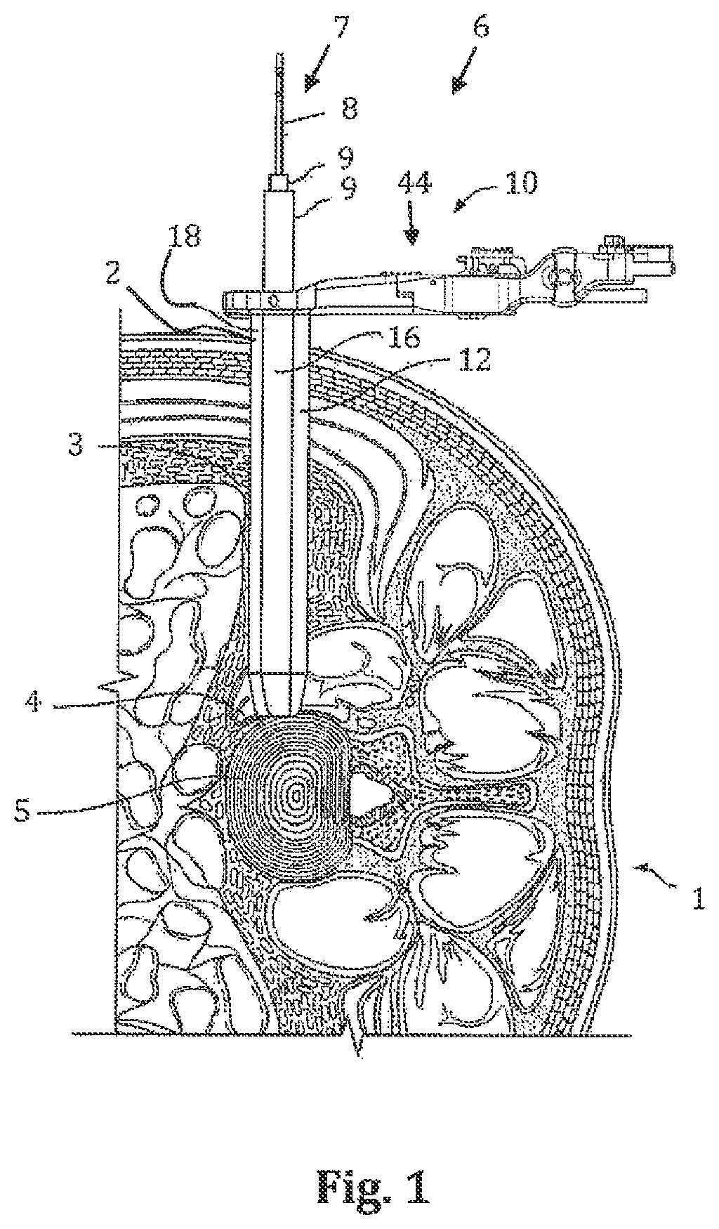 Patent US12426866 — Surgical access system and related methods — Figure 1