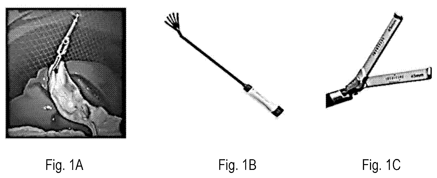 Patent US12426867 — Systems and methods for organ retraction and space opening — Figure 1