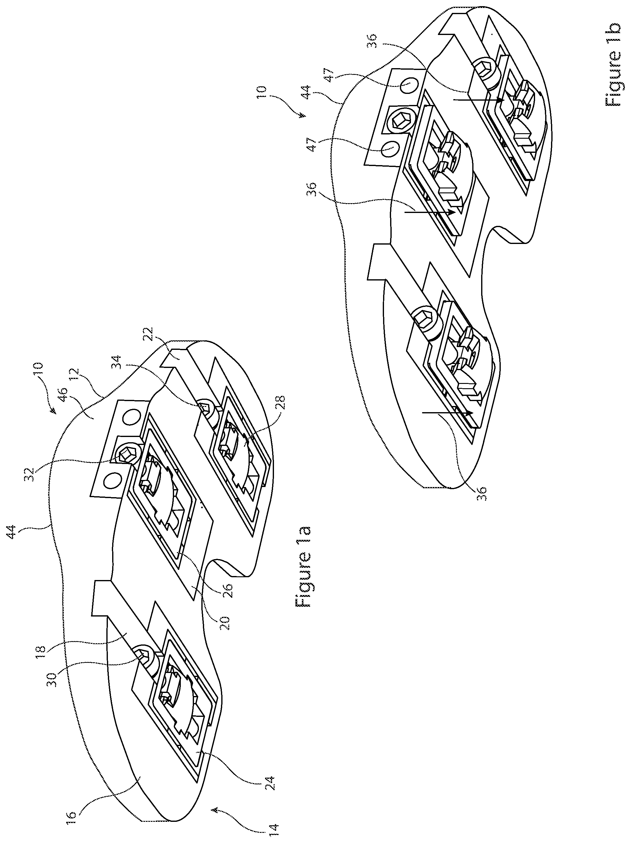 Patent US12426895 — Arrangement and method used in the preparation of bone surfaces of the knee joint for the components of a prosthetic knee joint — Figure 1