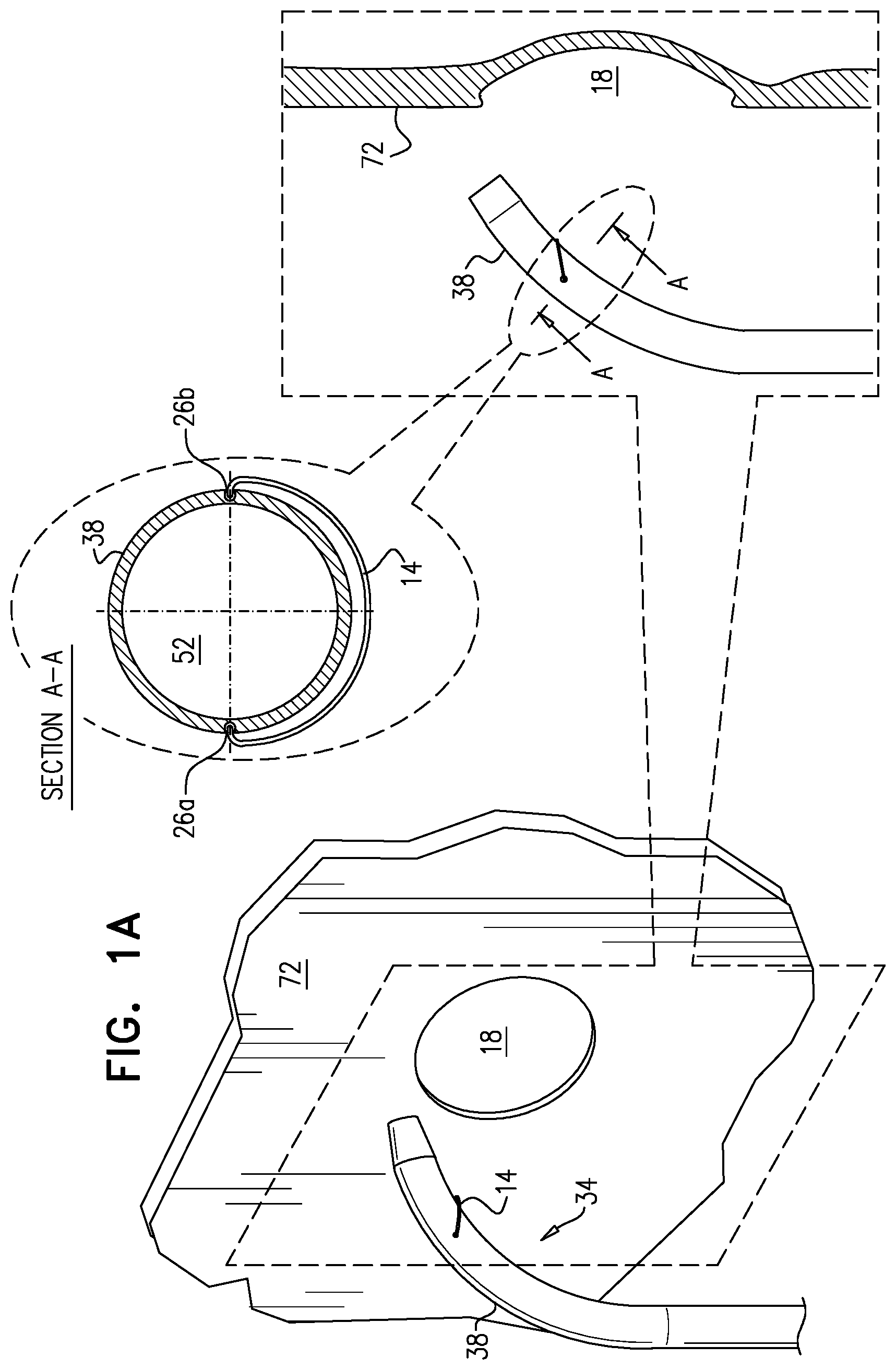 Patent US12426922 — Fossa ovalis penetration catheter — Figure 1