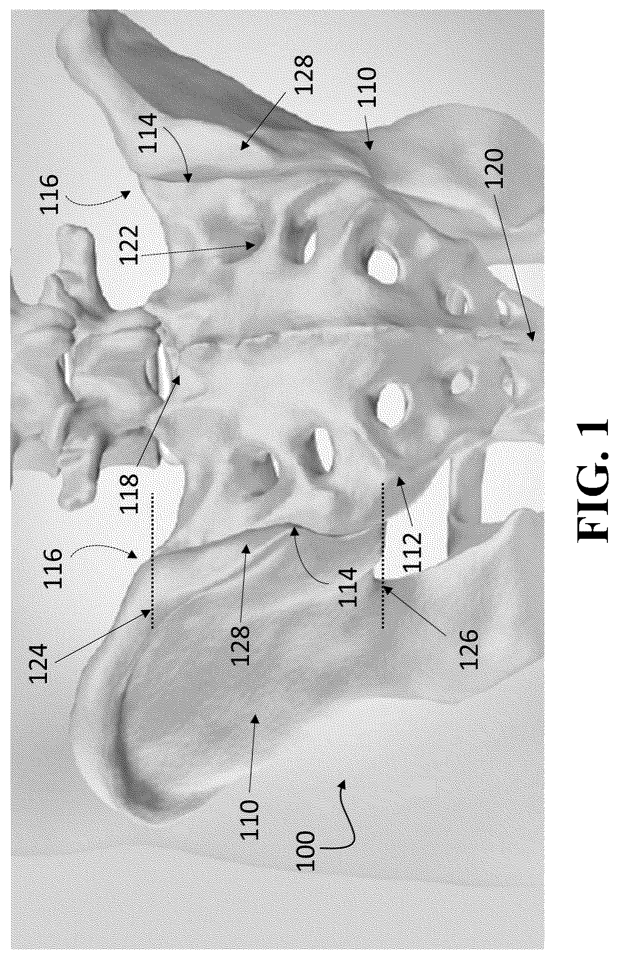 Patent US12426926 — Hybrid approach methods for sacroiliac joint stabilization — Figure 1