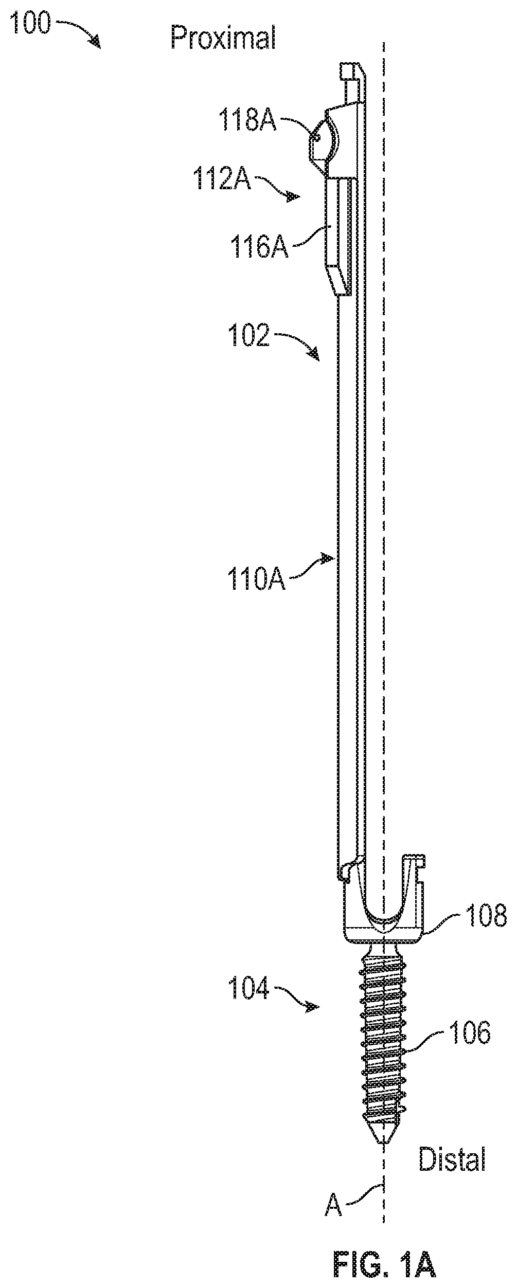 Patent US12426927 — Split tower for a bone anchor — Figure 1