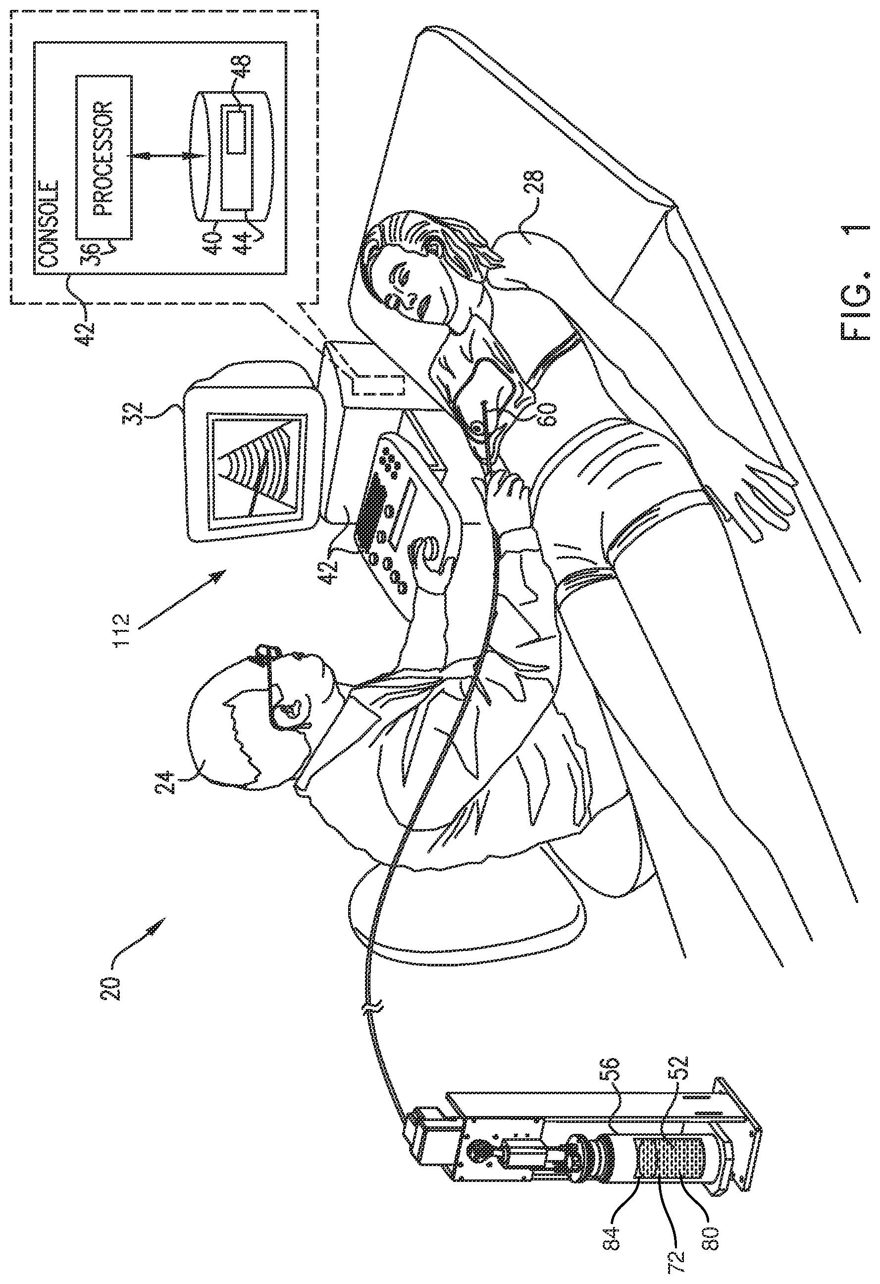 Patent US12426934 — Cryogen flow control — Figure 1