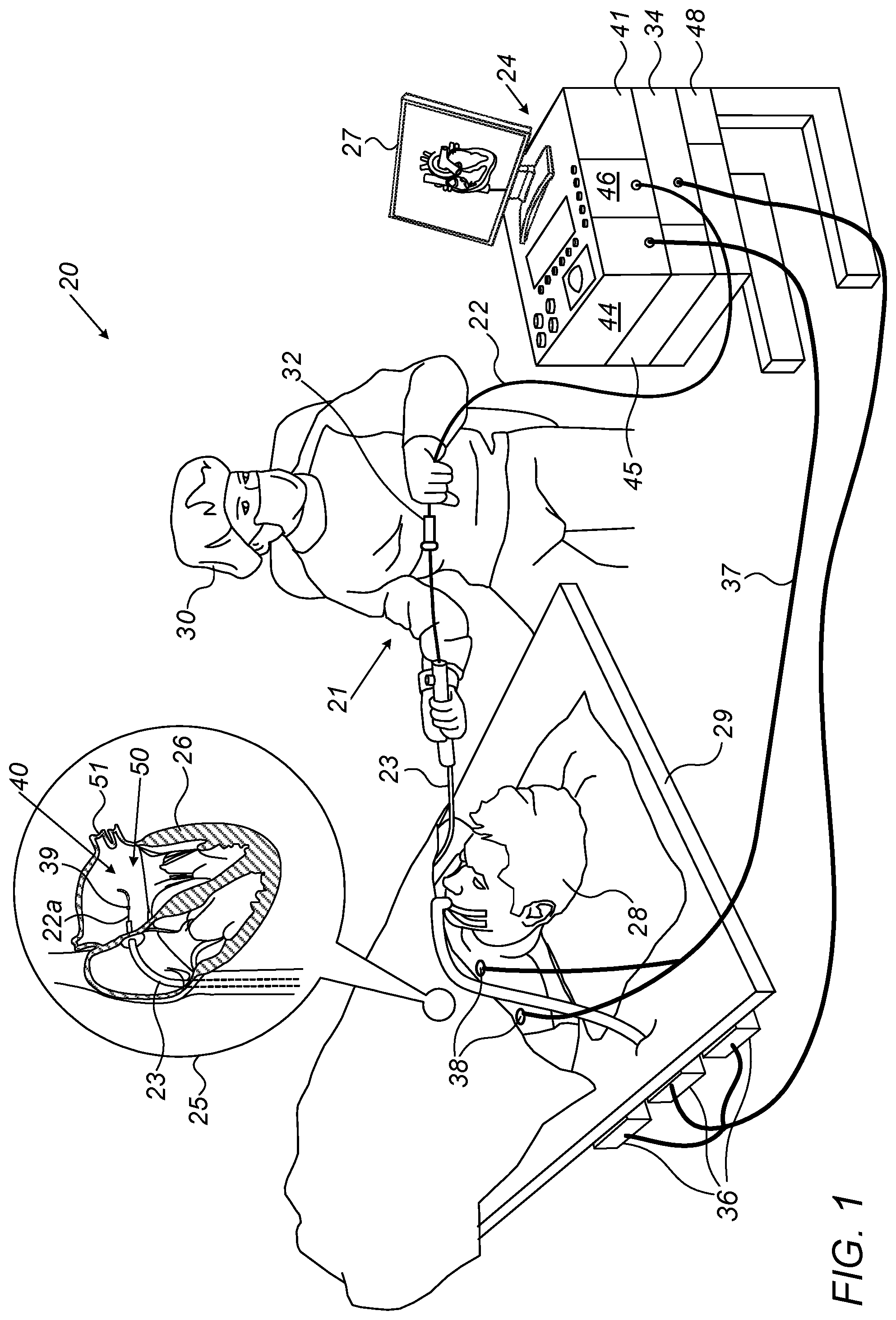Patent US12426944 — Automatically performing irreversible electroporation ablation during heart refractory period — Figure 1