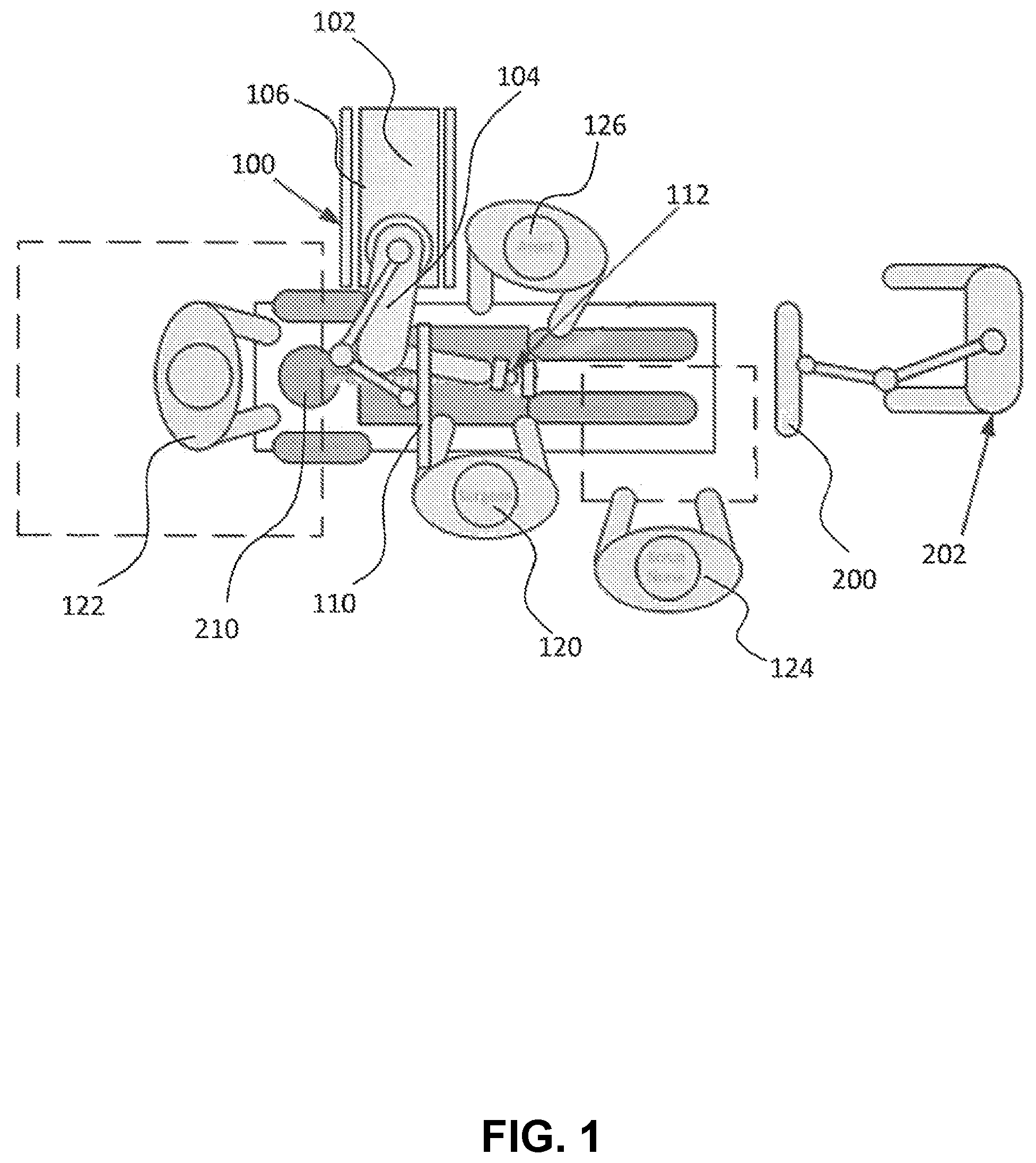 Patent US12426958 — Navigated pelvic implant system and associated method of use — Figure 1