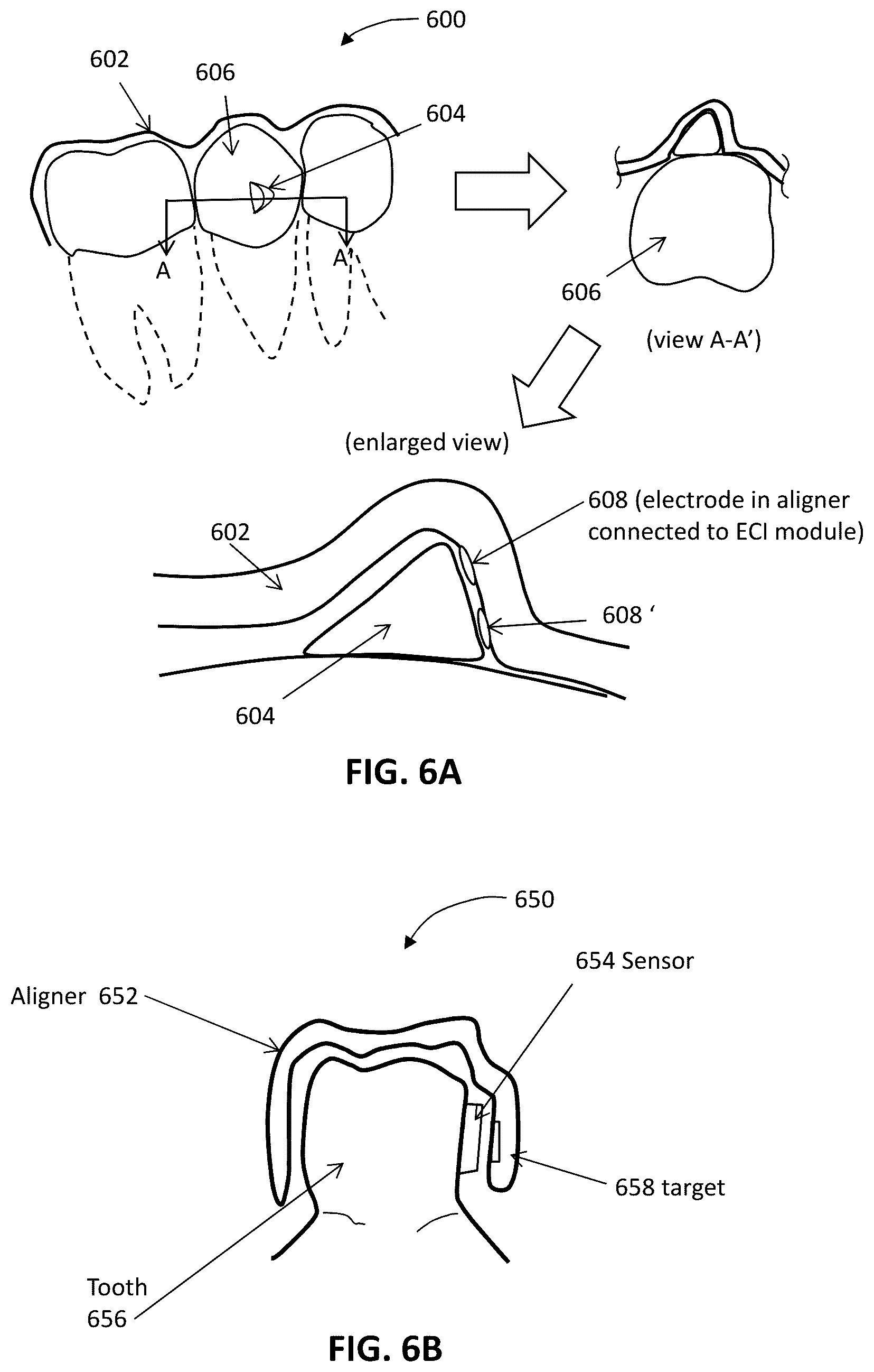 Patent US12426992 Figure 6 – Systems including orthodontic appliance cases and methods of use