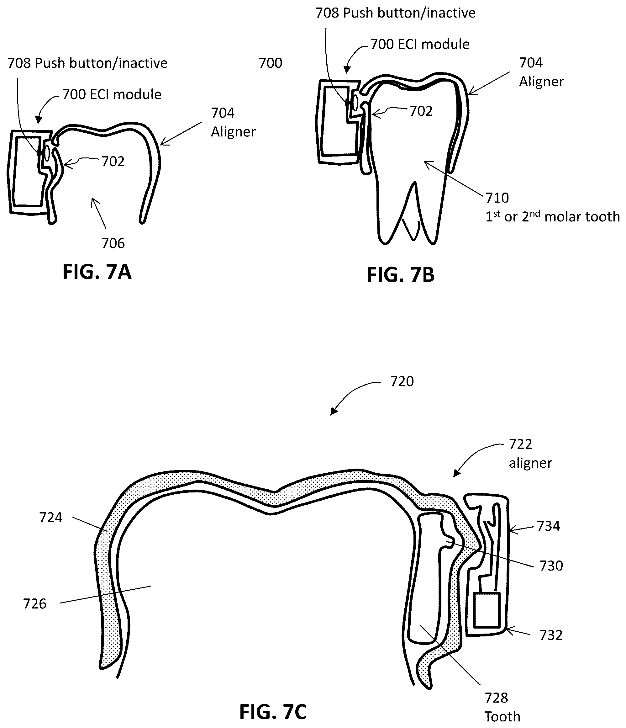 Patent US12426992 Figure 7 – Systems including orthodontic appliance cases and methods of use