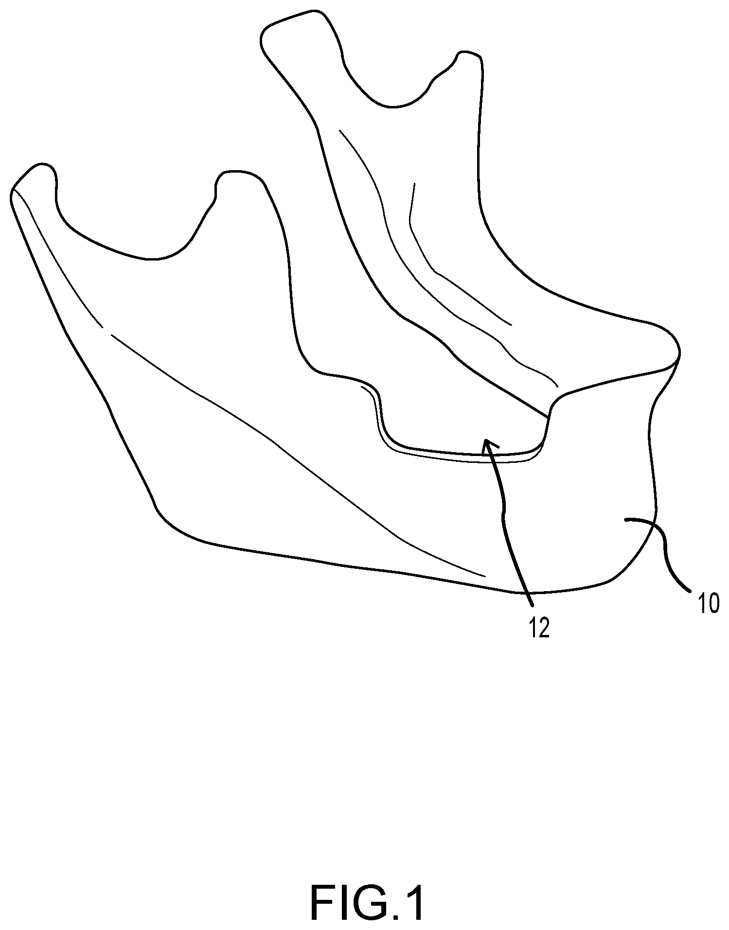 Patent US12426996 — Dental membrane — Figure 1
