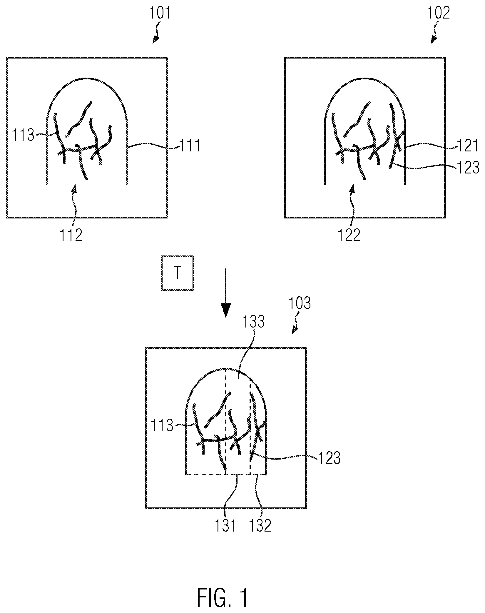 Patent US12437425 — Computer-implemented method for determining an affine transformation — Figure 1