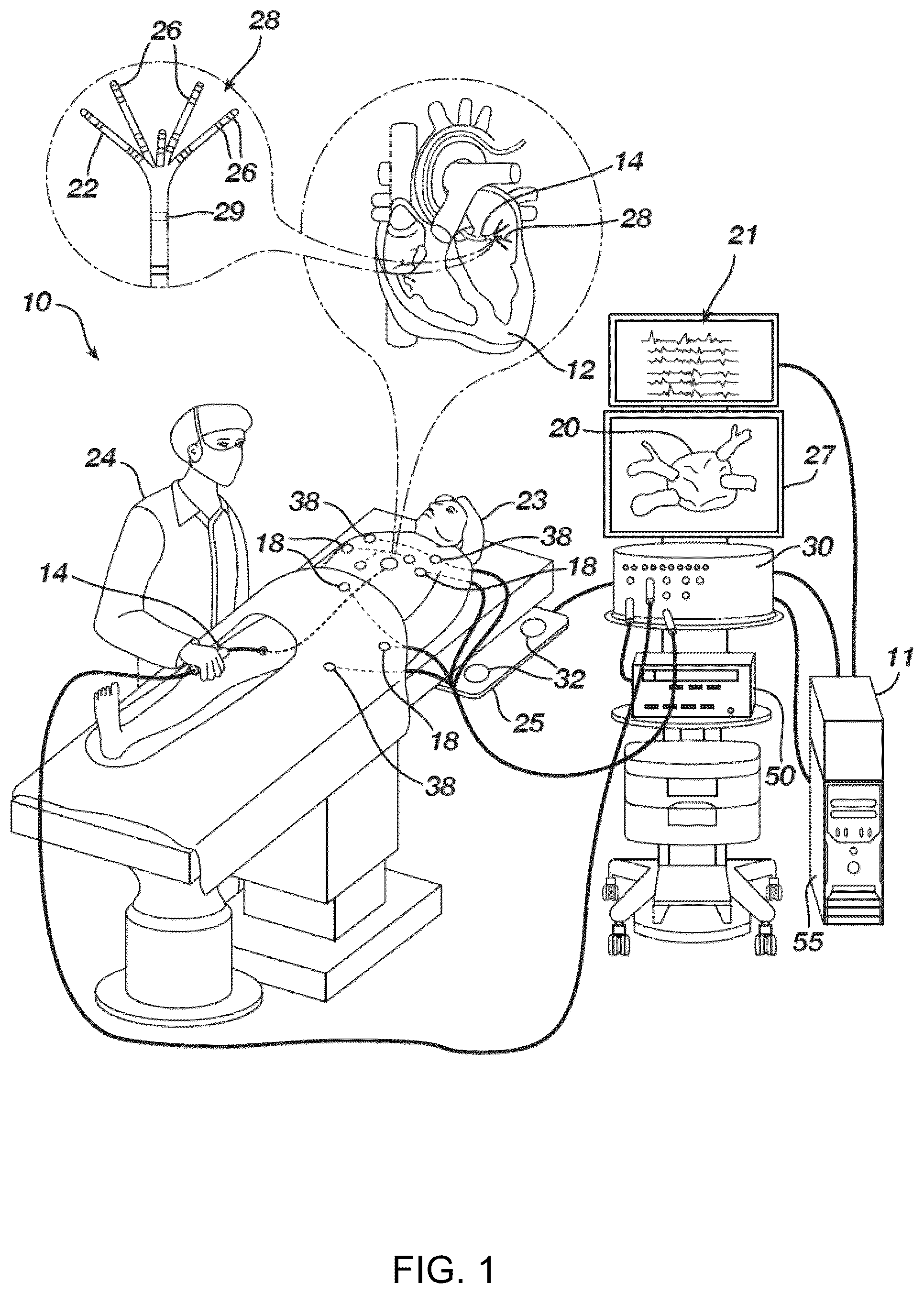 Patent US12437466 — Using signed distance functions to visualize pulsed field ablation (PFA) tags — Figure 1