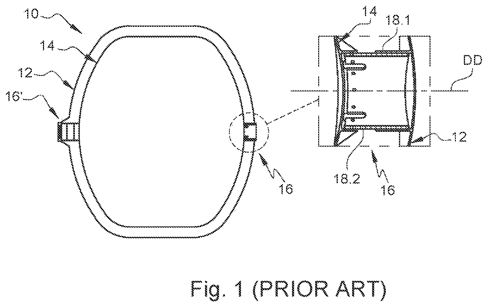 Patent US12455045 — Tank comprising inner and outer enclosures and at least one annular linear connection system connecting said enclosures — Figure 1